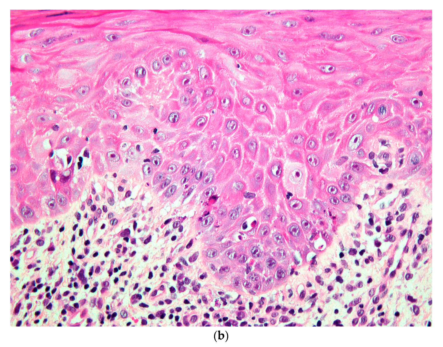 Dermatopathology 07 00004 g002b Dermatopathology 07 00004 g002b