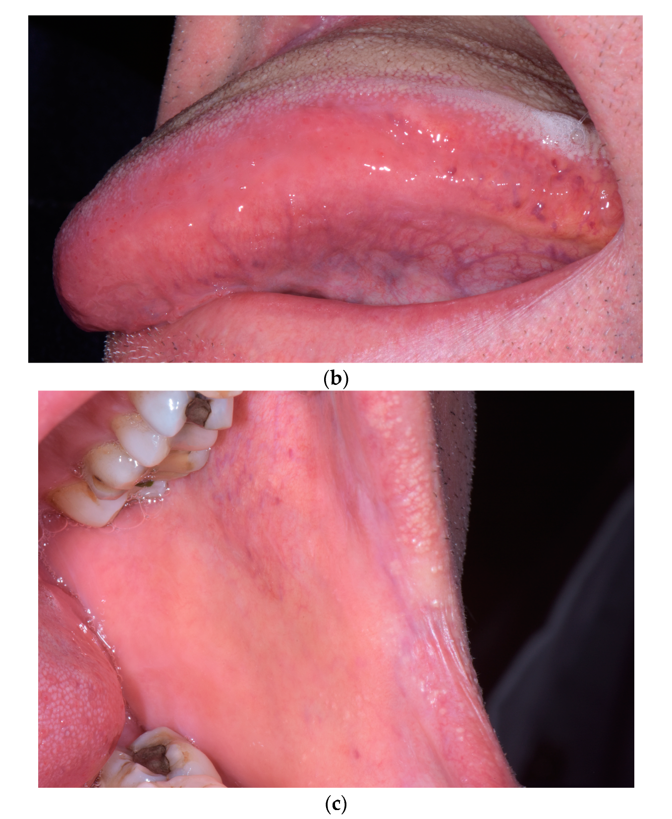 Dermatopathology 07 00004 g003b Dermatopathology 07 00004 g003b