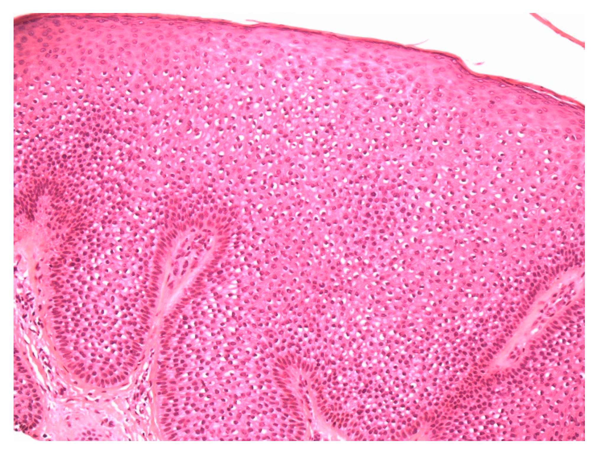 Dermatopathology 07 00005 g002 Dermatopathology 07 00005 g002