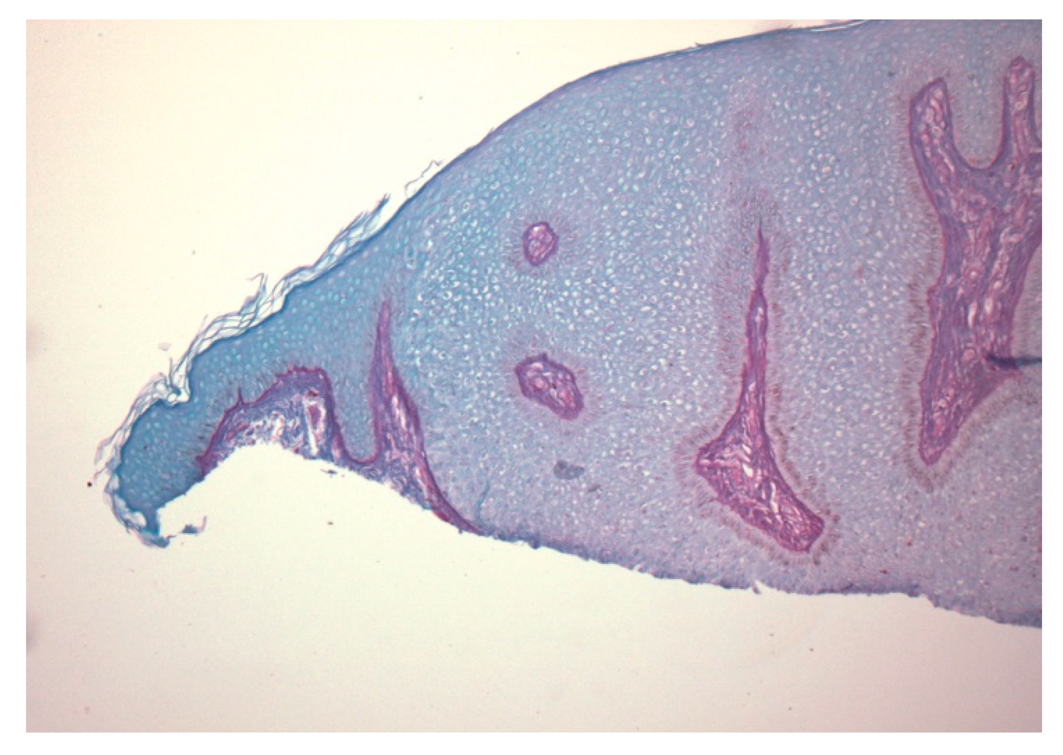 Dermatopathology 07 00005 g004 Dermatopathology 07 00005 g004