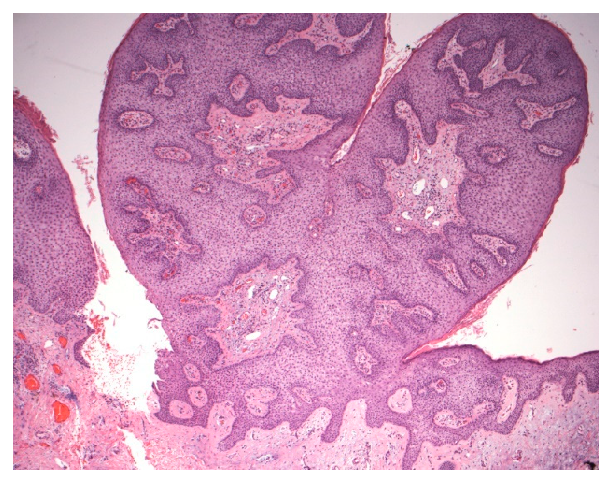 Dermatopathology 07 00005 g006 Dermatopathology 07 00005 g006