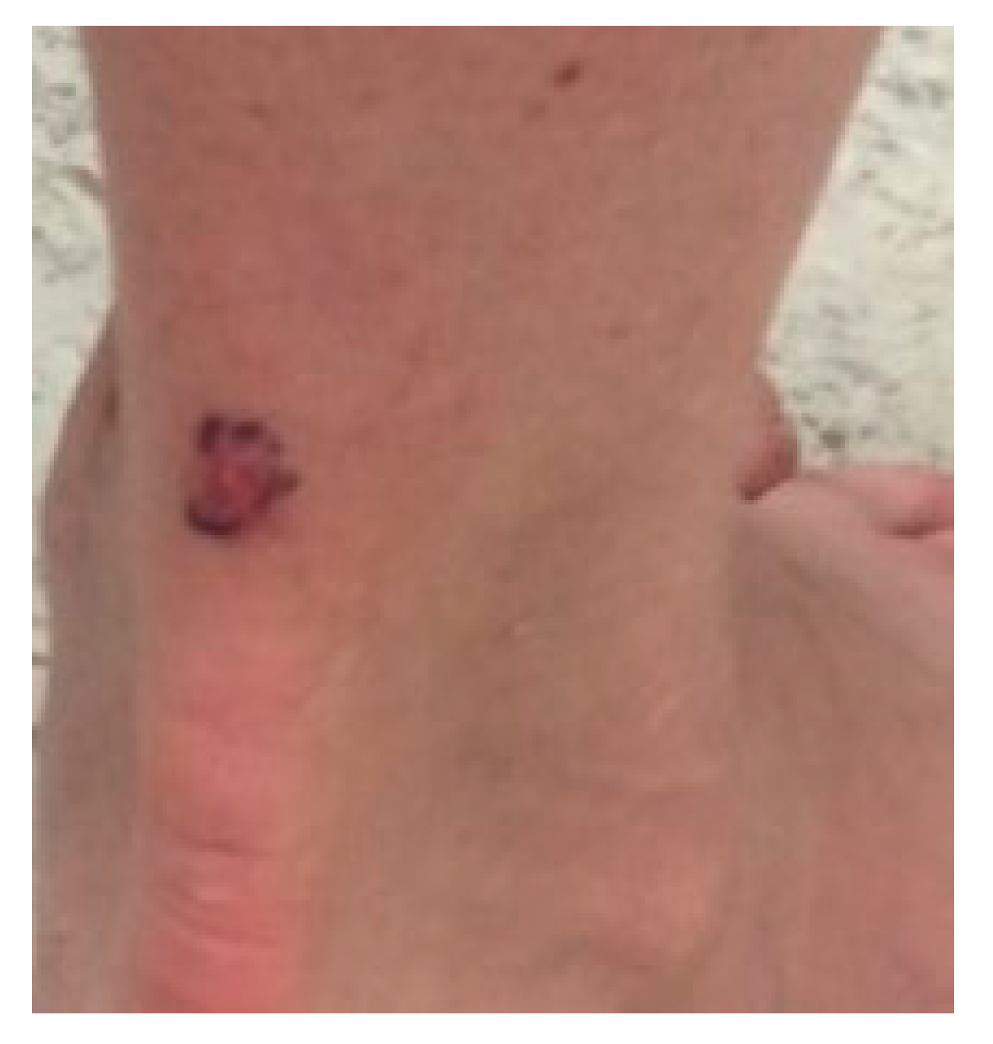 Dermatopathology 07 00005 g007 Dermatopathology 07 00005 g007