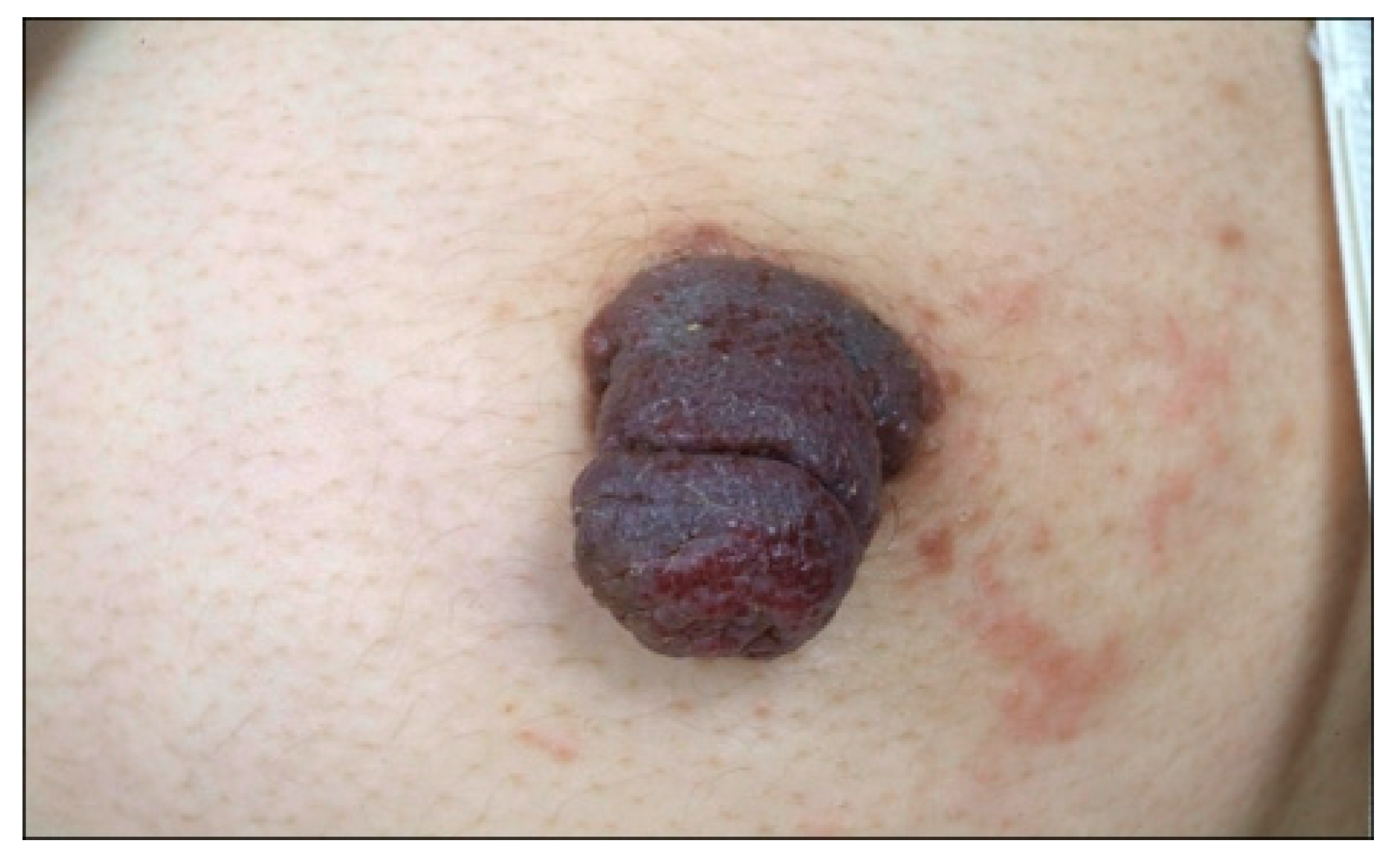 Dermatopathology 07 00005 g008 Dermatopathology 07 00005 g008