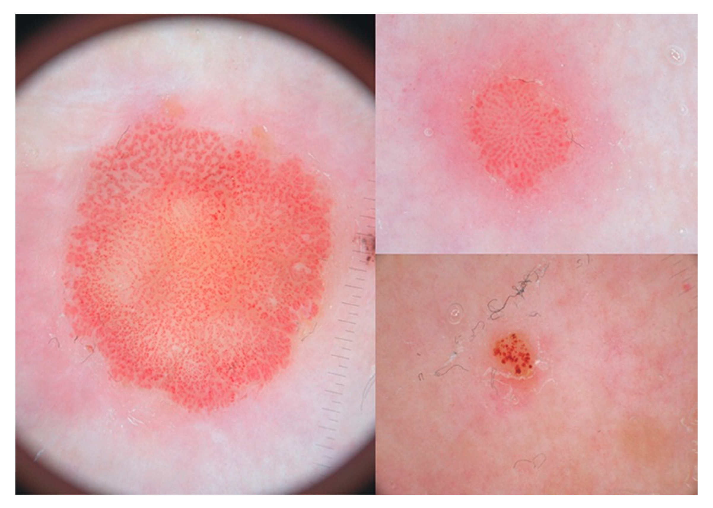 Dermatopathology 07 00005 g009 Dermatopathology 07 00005 g009