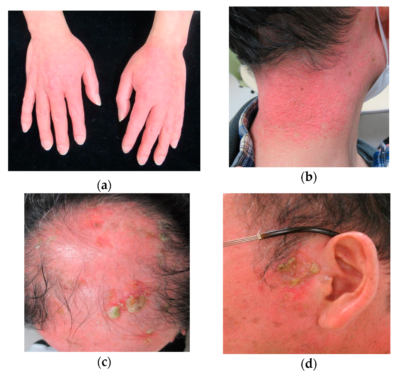 Dermatopathology 07 00008 g001 Dermatopathology 07 00008 g001