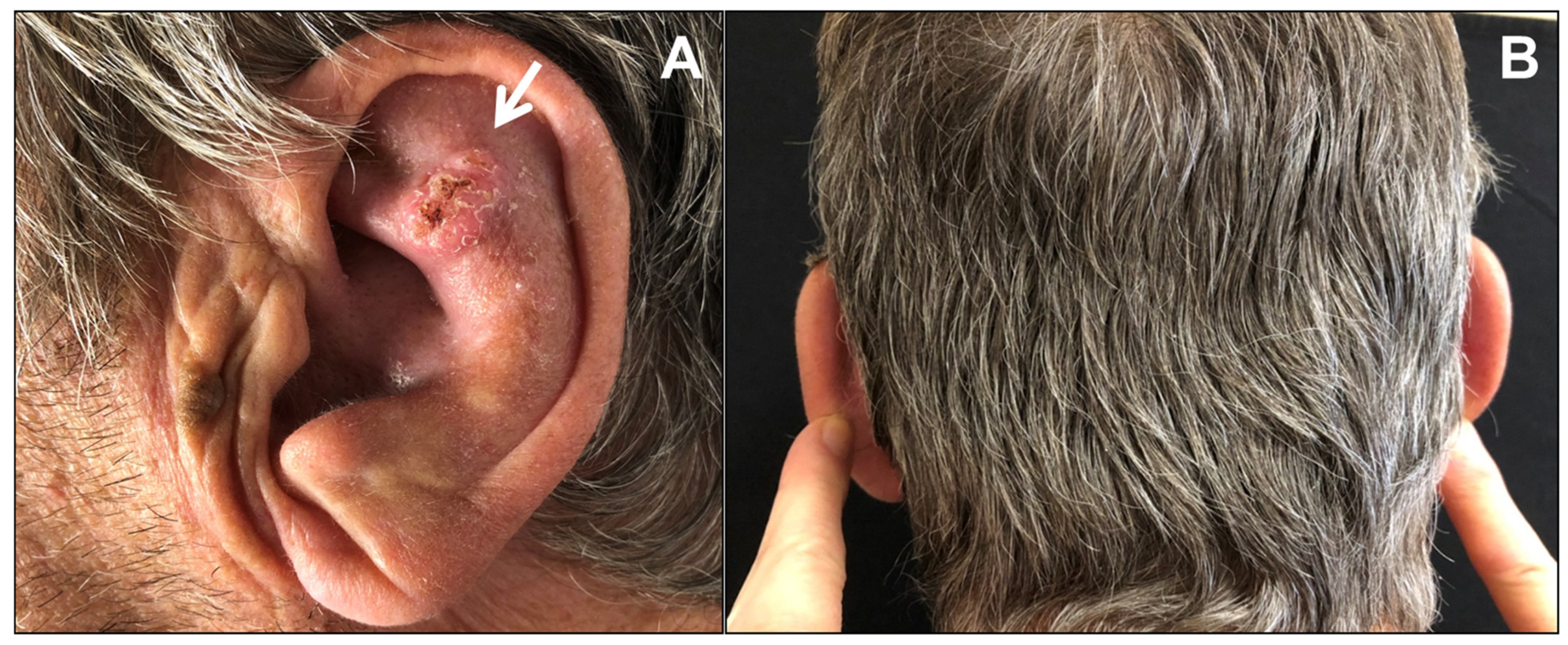 Dermatopathology 08 00009 g001