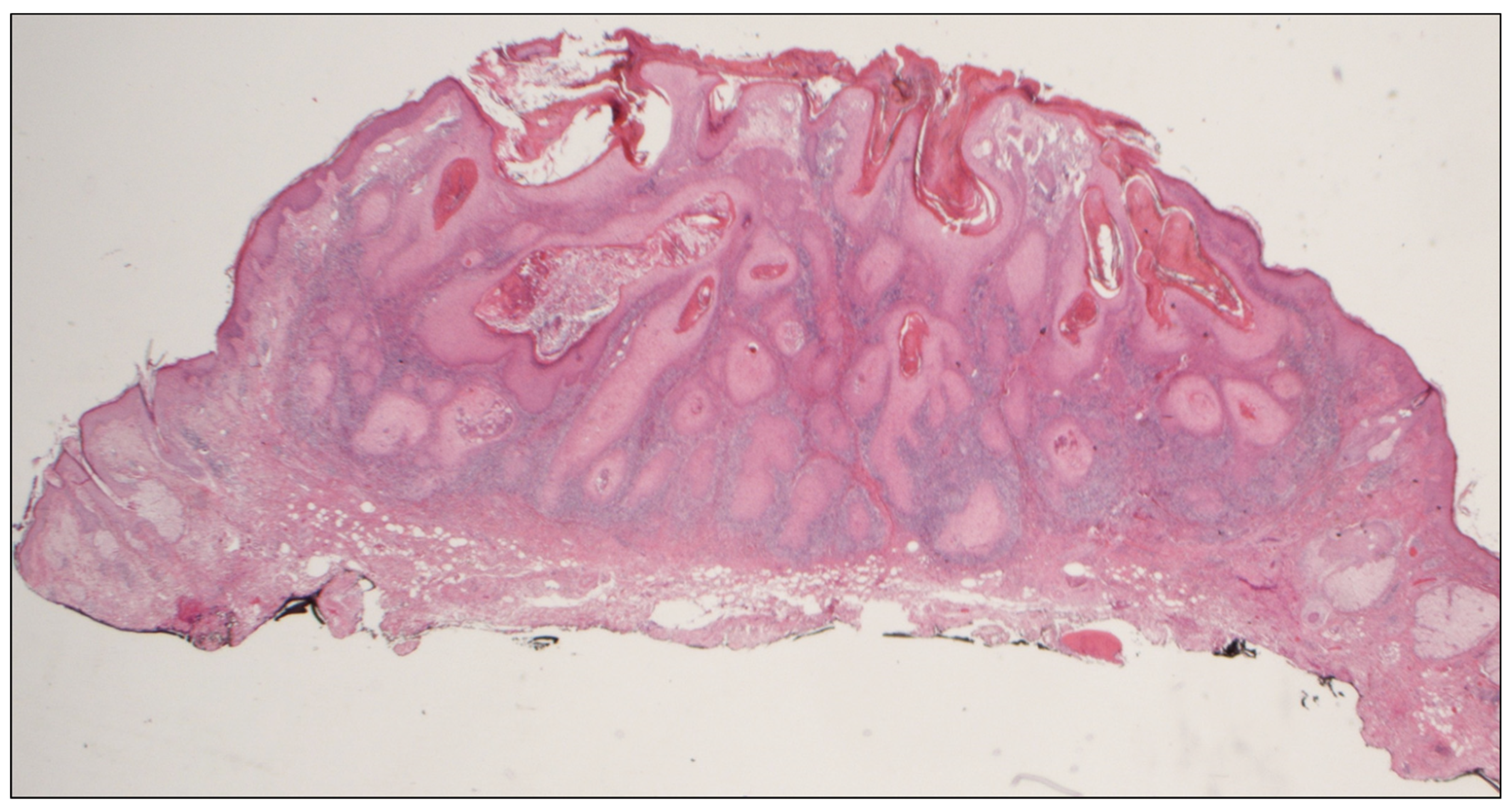 Dermatopathology 08 00009 g003