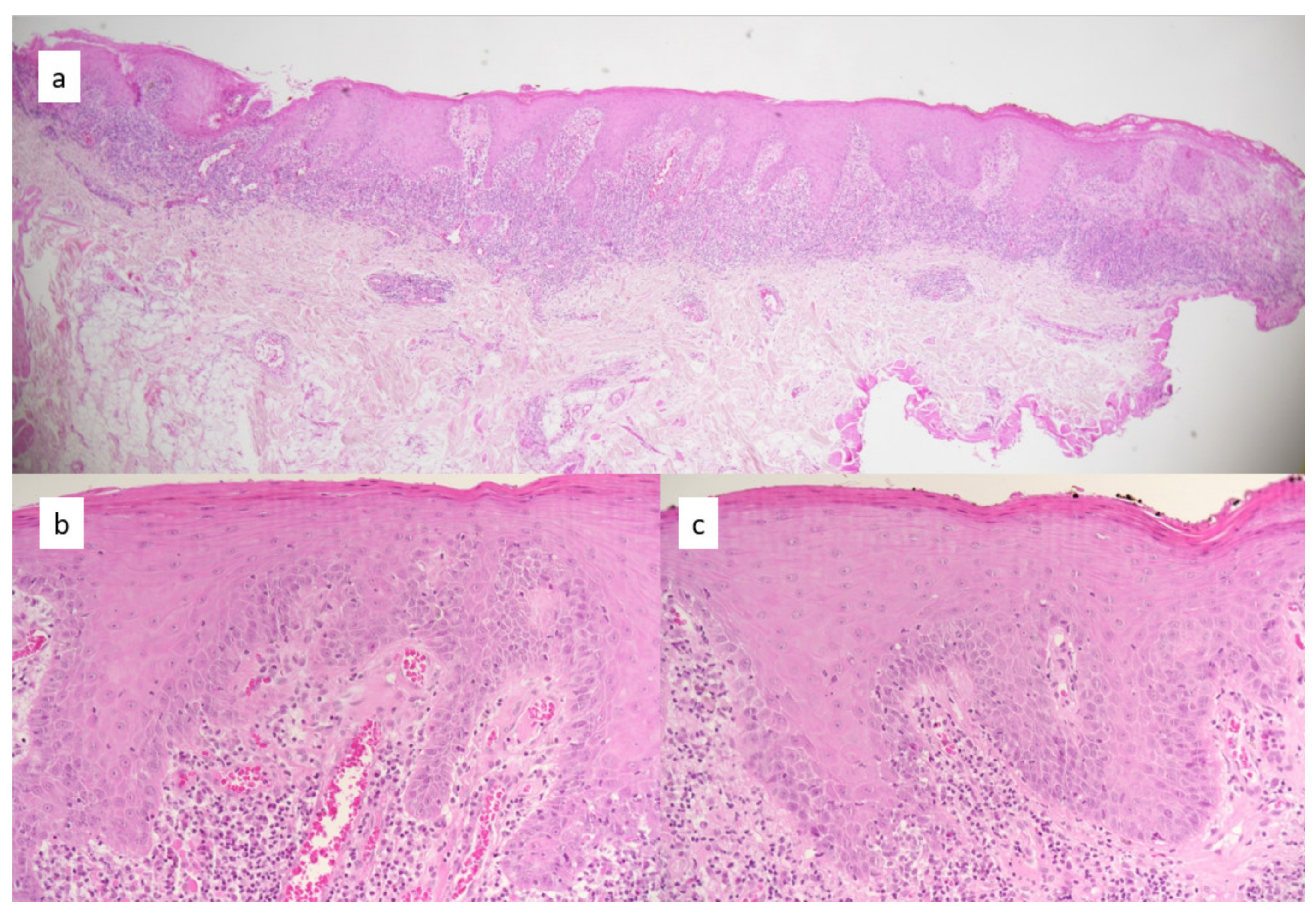 Dermatopathology 08 00013 g001