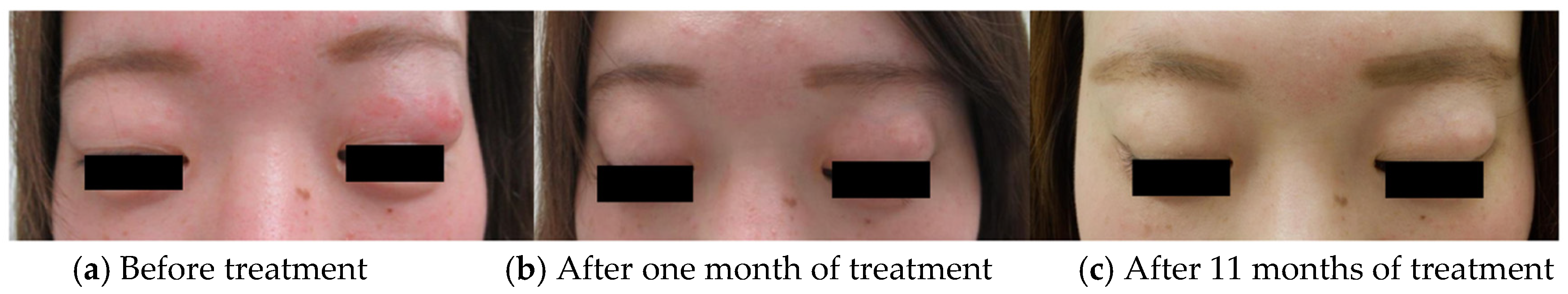Dermatopathology 08 00018 g003 Dermatopathology 08 00018 g003