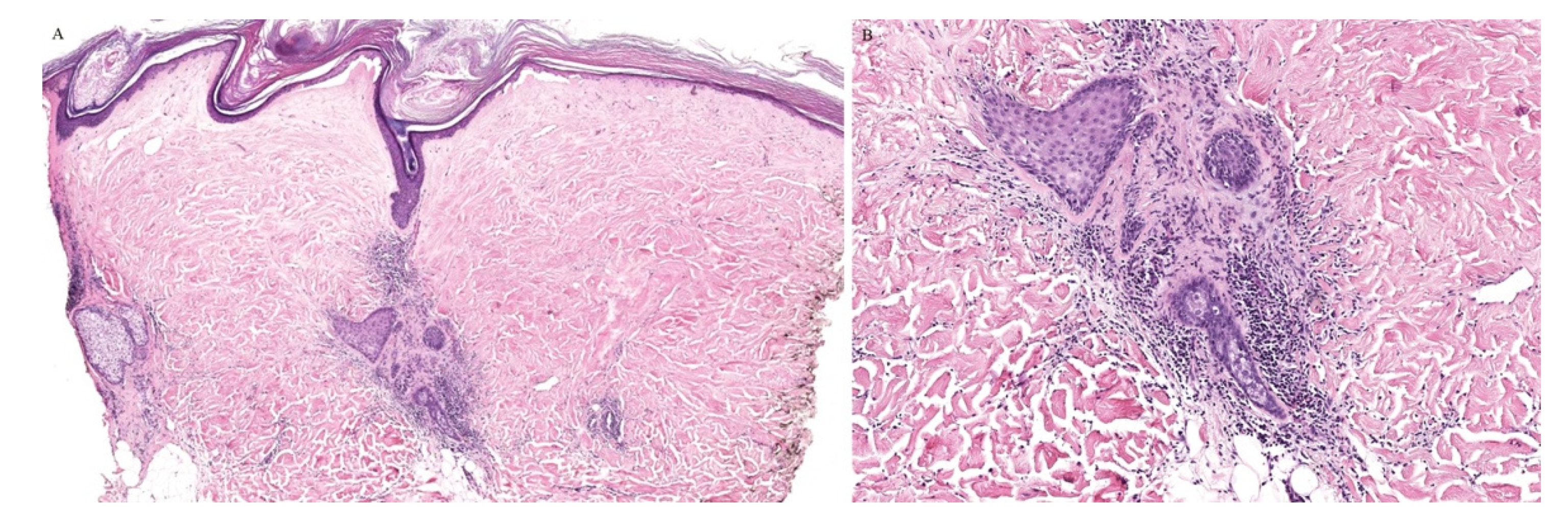 Dermatopathology 08 00020 g004