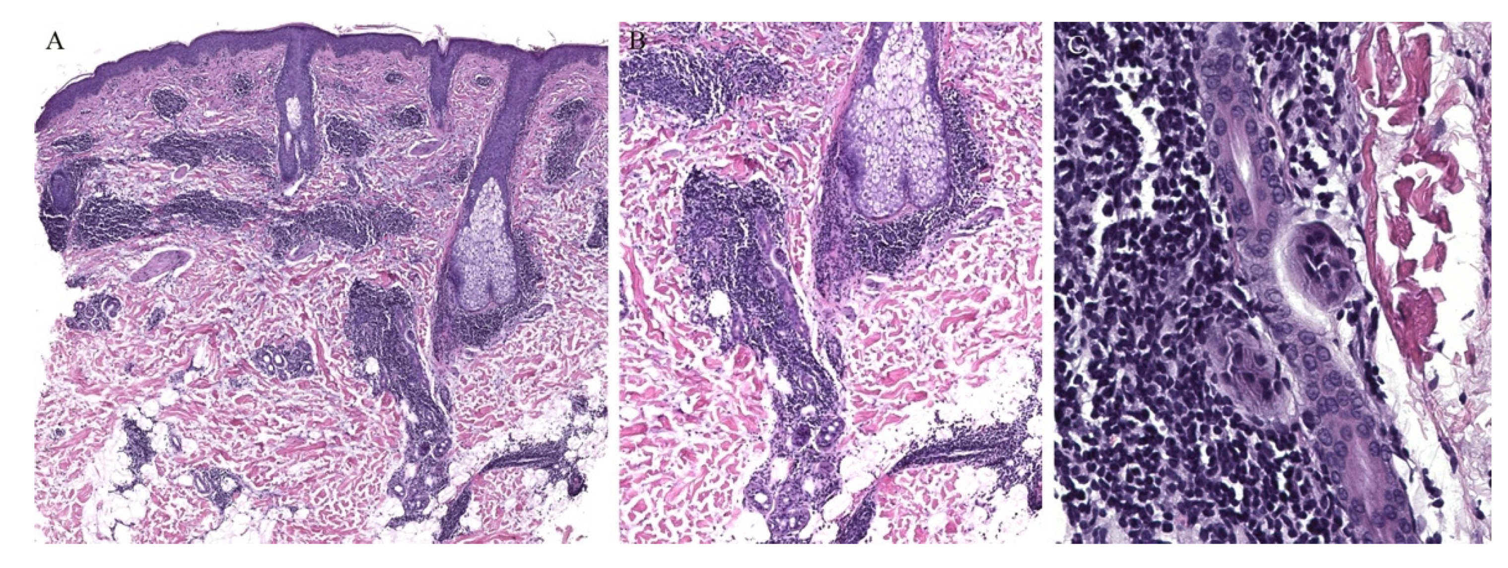 Dermatopathology 08 00020 g005