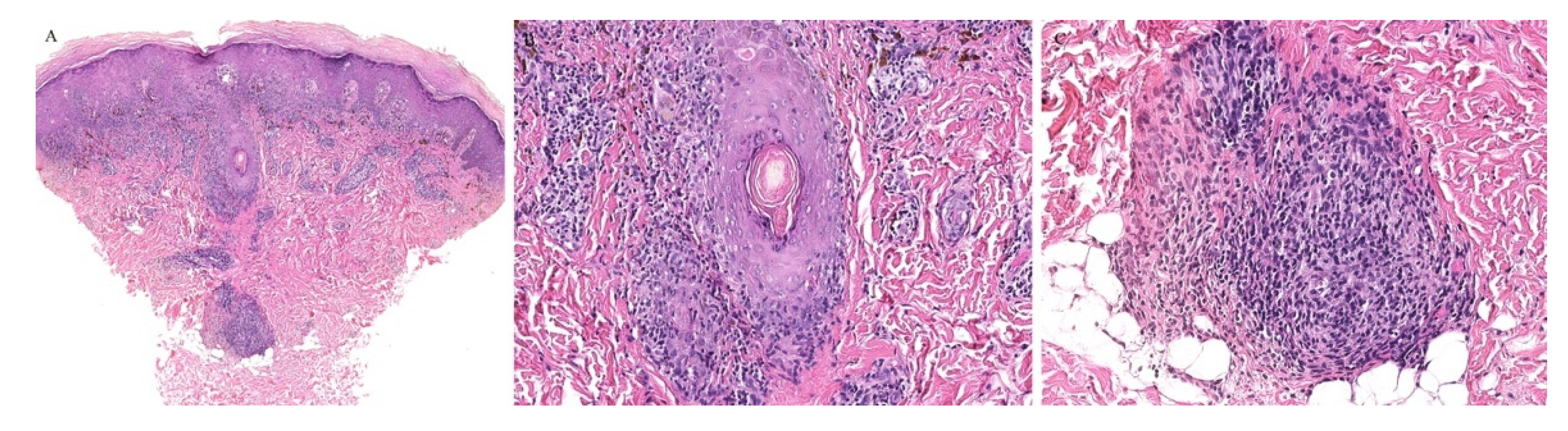 Dermatopathology 08 00020 g006