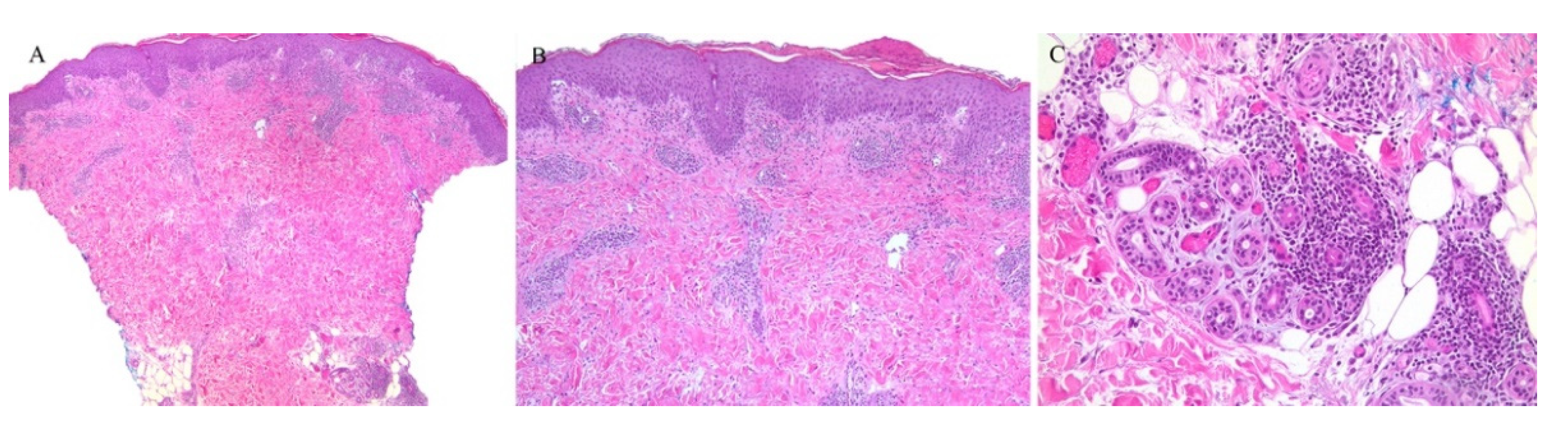 Dermatopathology 08 00020 g008