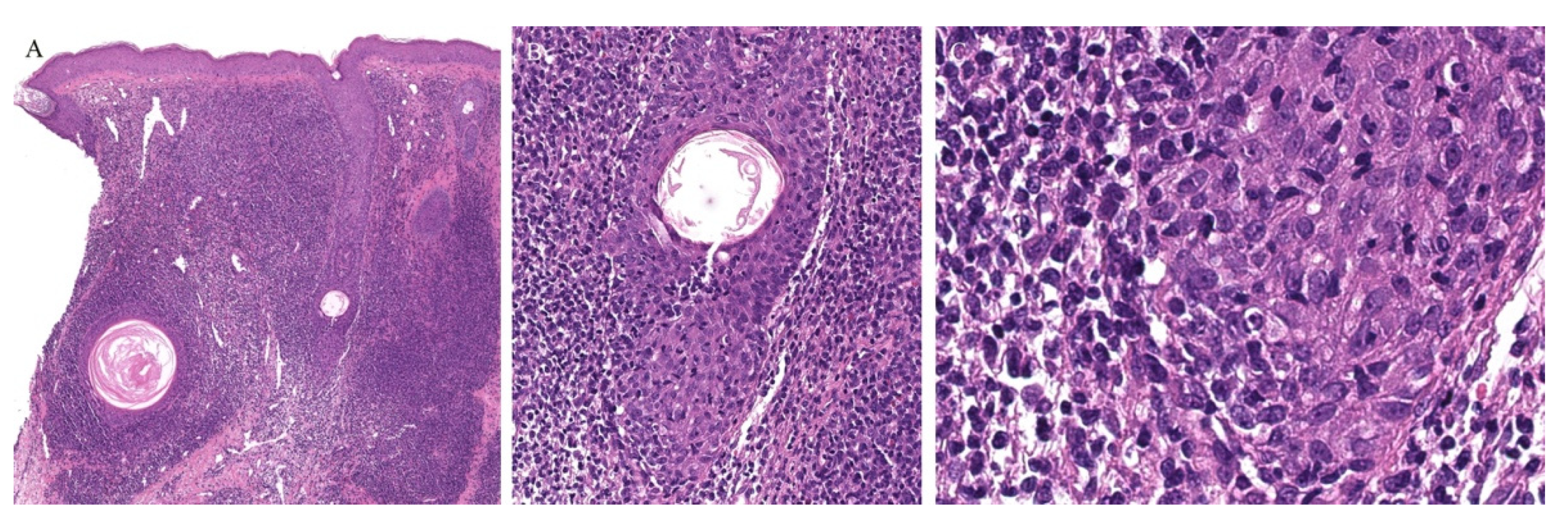 Dermatopathology 08 00020 g010