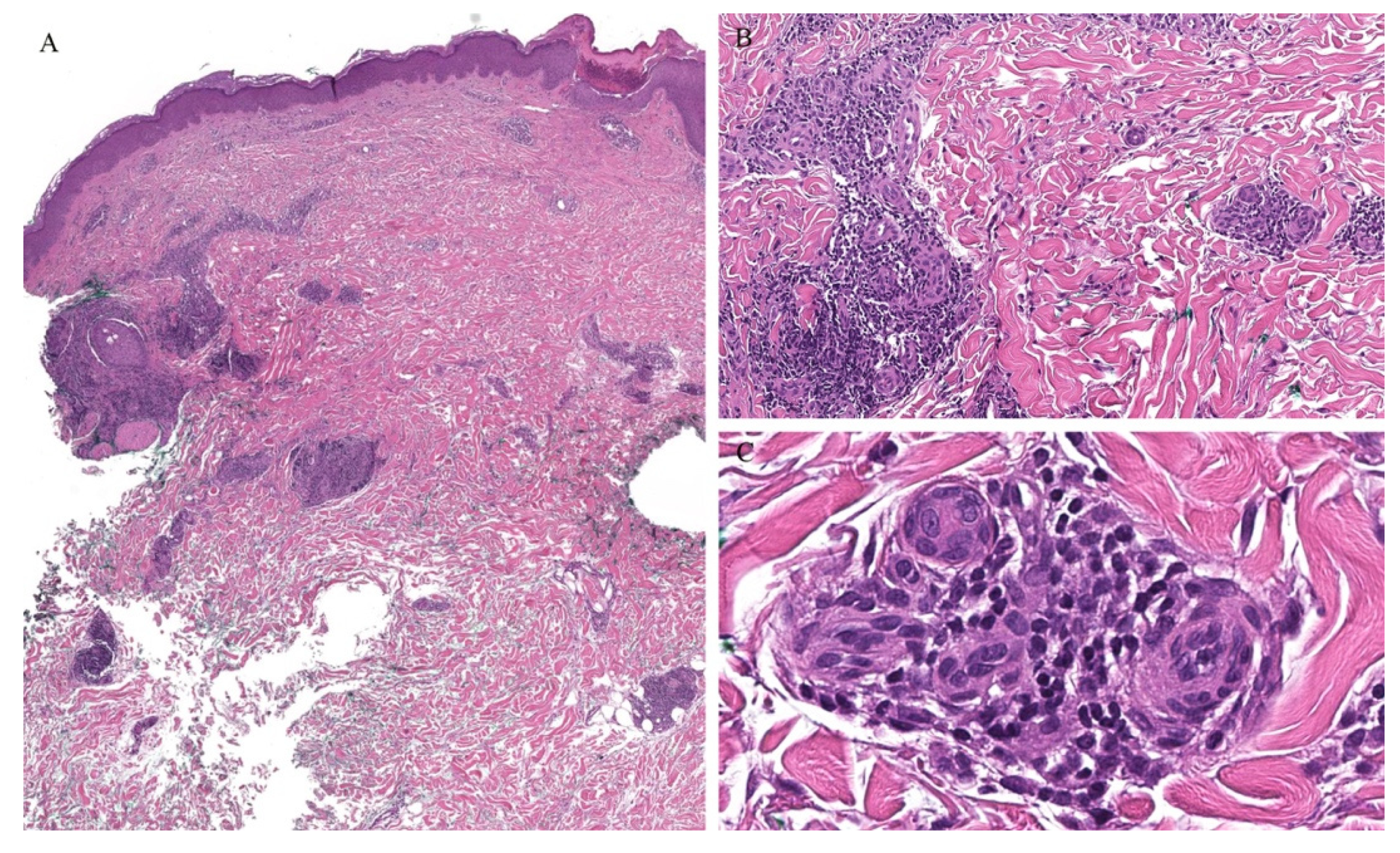 Dermatopathology 08 00020 g011