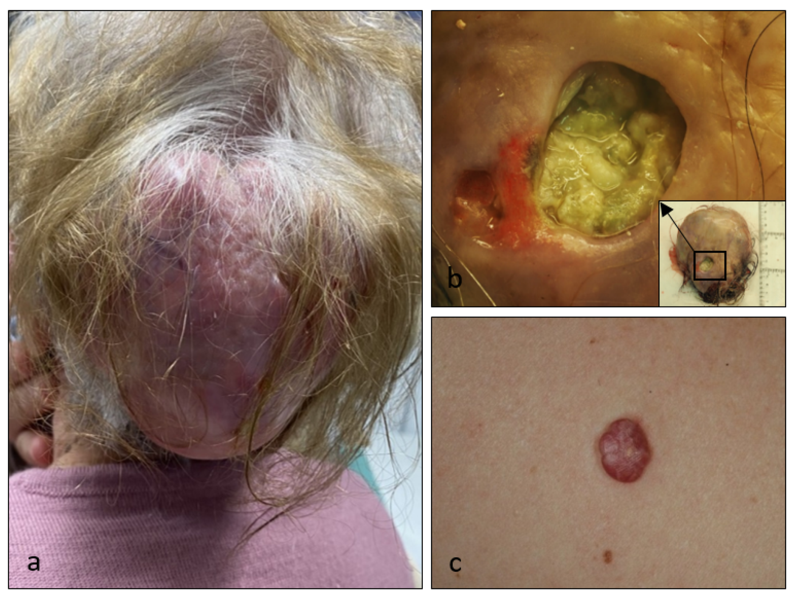 Dermatopathology 08 00021 g001 Dermatopathology 08 00021 g001