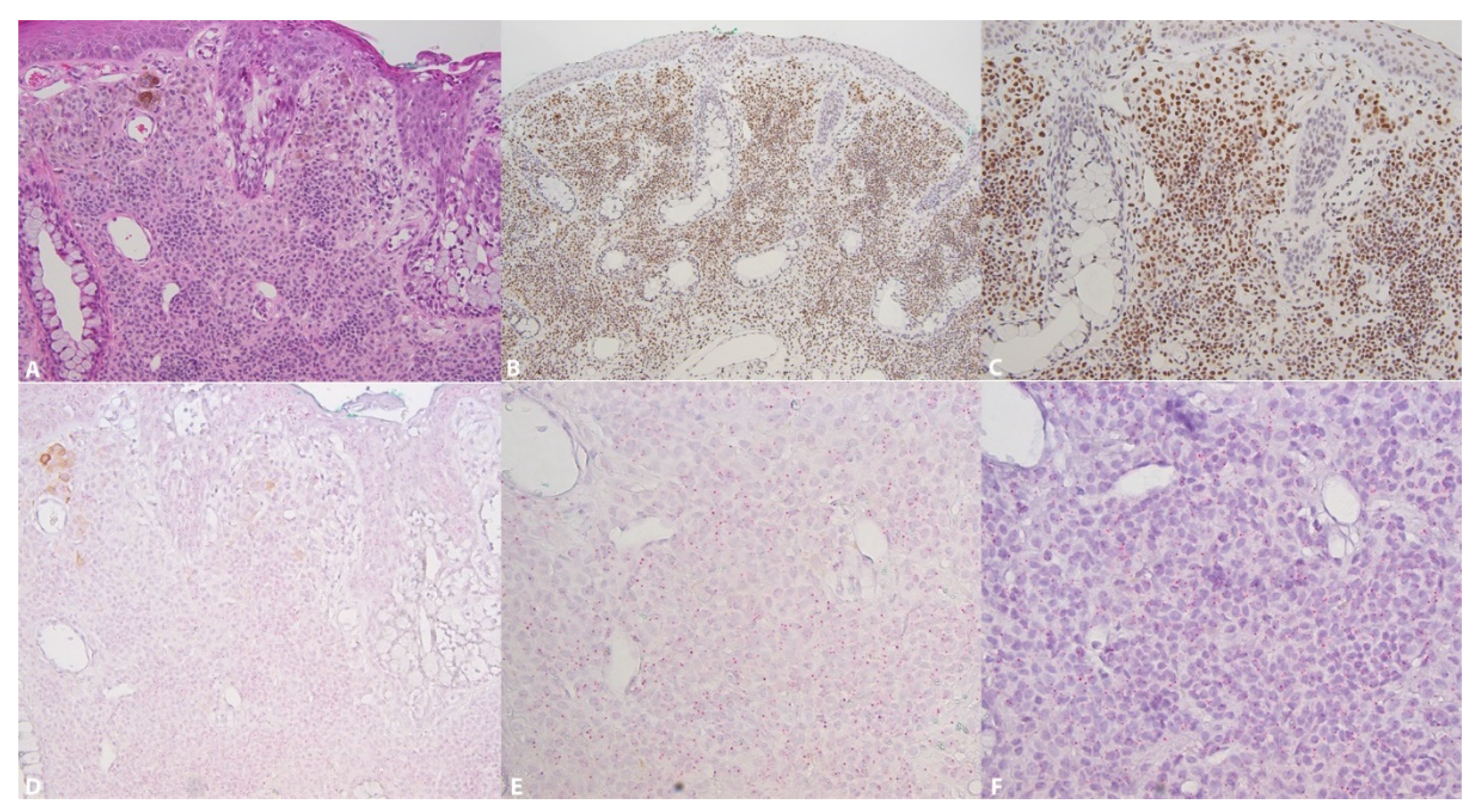 Dermatopathology 08 00023 g001 Dermatopathology 08 00023 g001