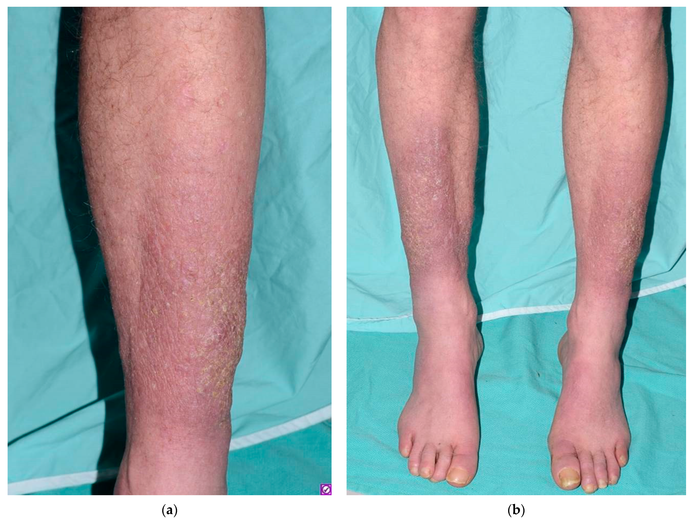 Dermatopathology 08 00024 g001 Dermatopathology 08 00024 g001