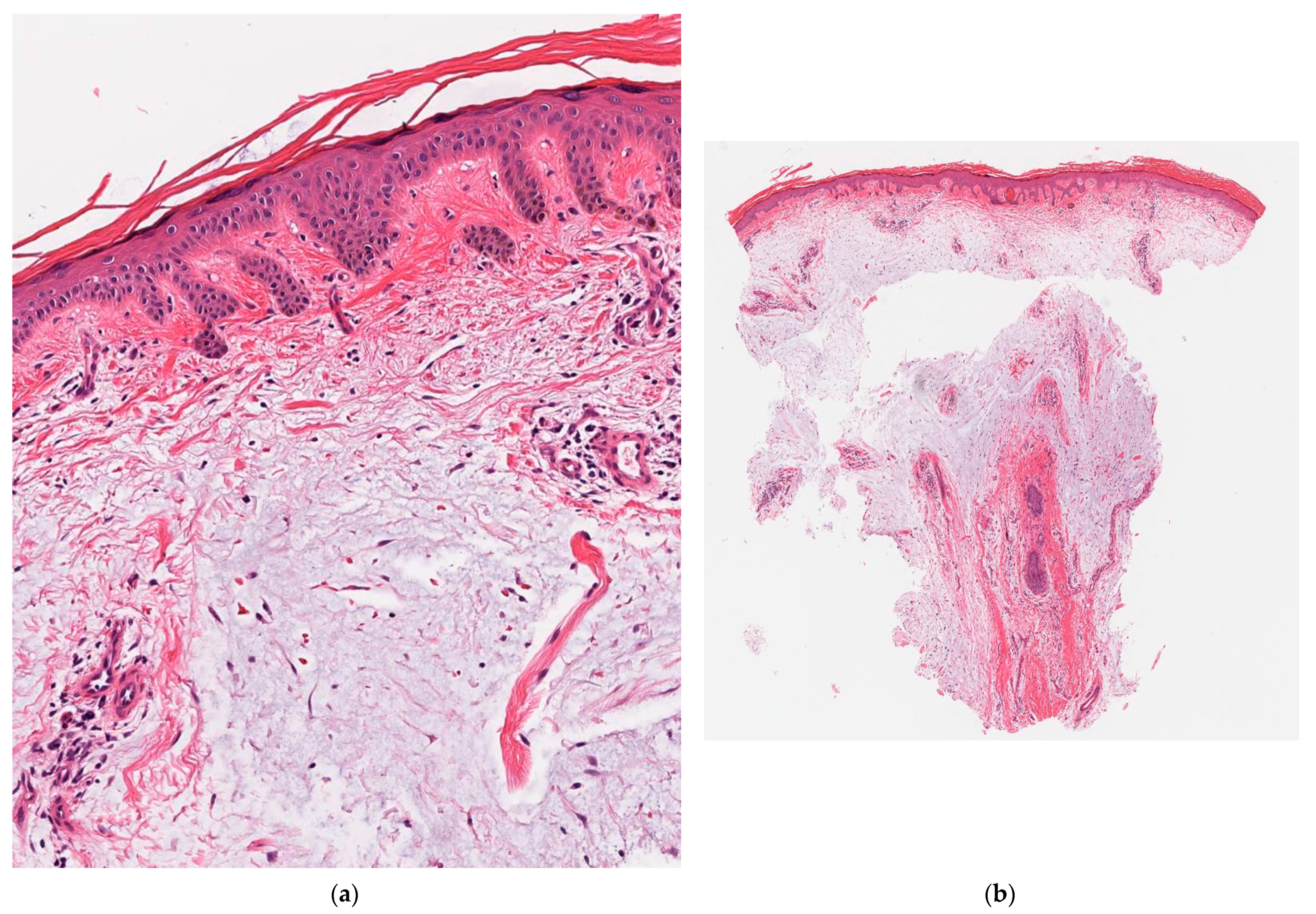 Dermatopathology 08 00024 g002 Dermatopathology 08 00024 g002