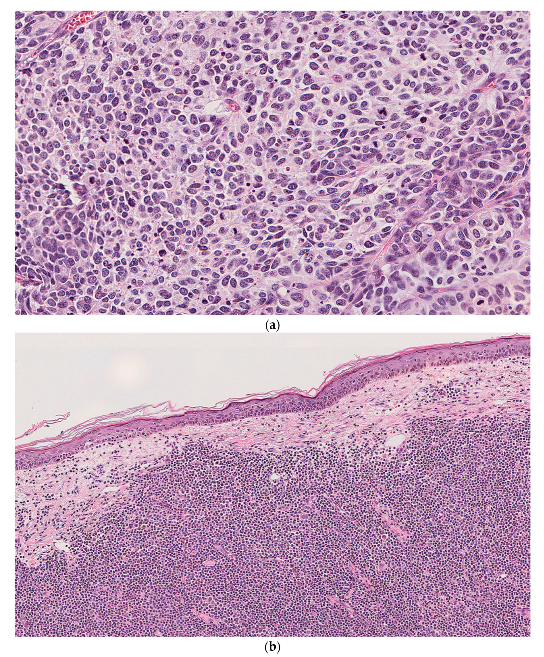 Dermatopathology 08 00025 g003a Dermatopathology 08 00025 g003a