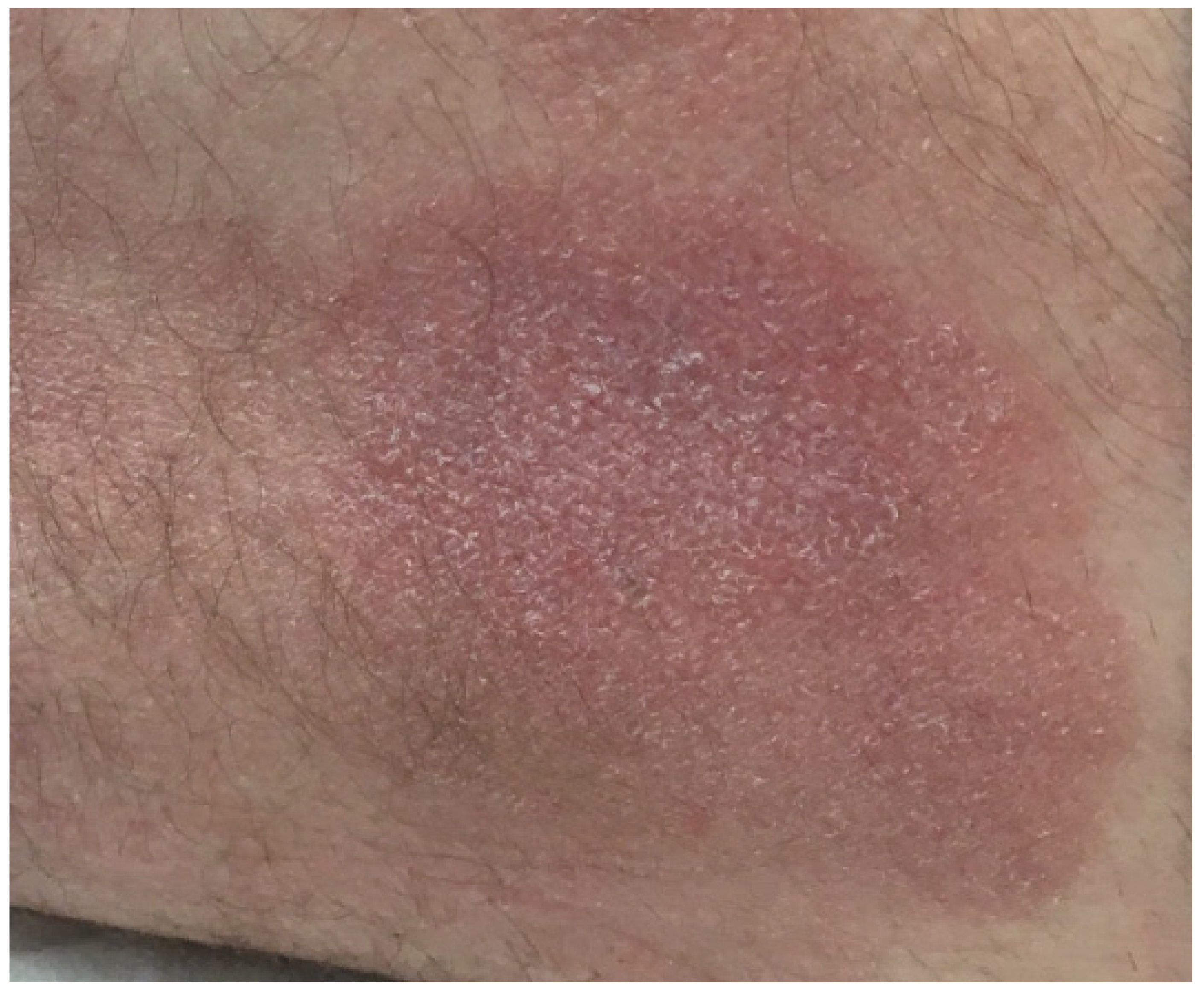 Dermatopathology 08 00034 g001 550