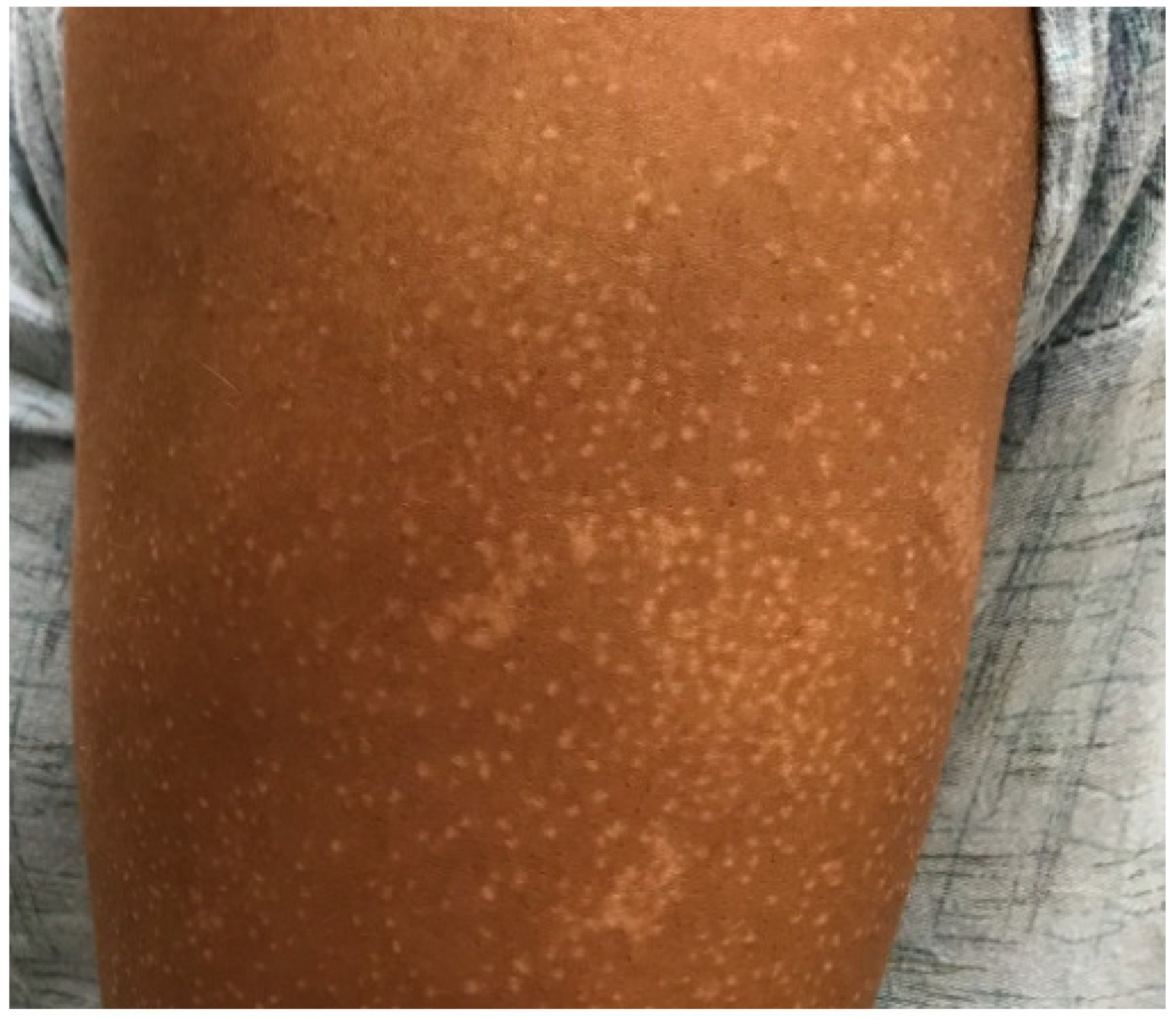 Dermatopathology 08 00034 g002 550