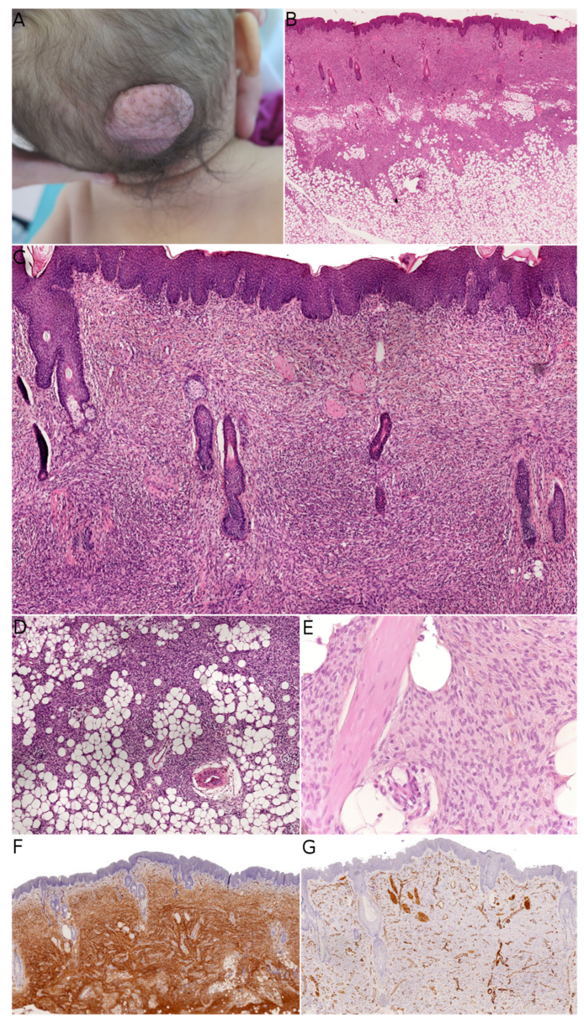 Dermatopathology 08 00035 g001 550