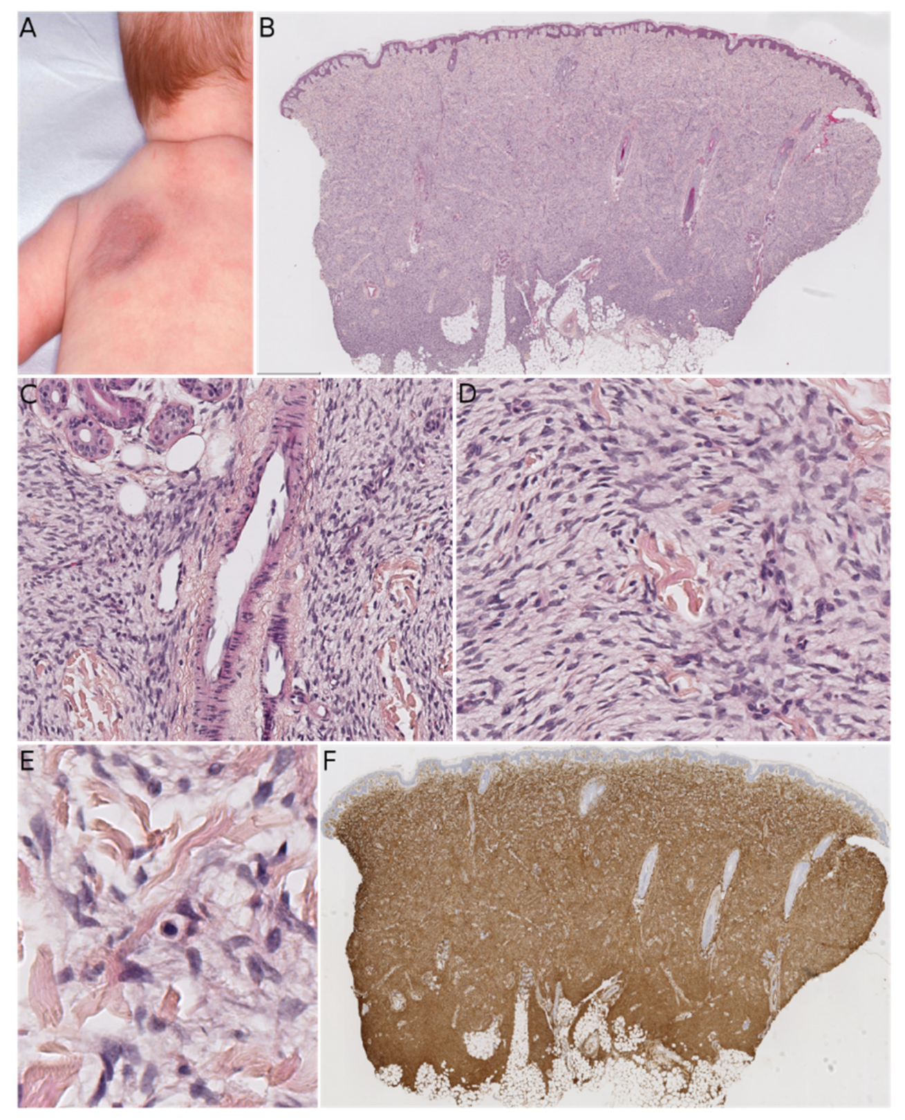 Dermatopathology 08 00035 g002 550
