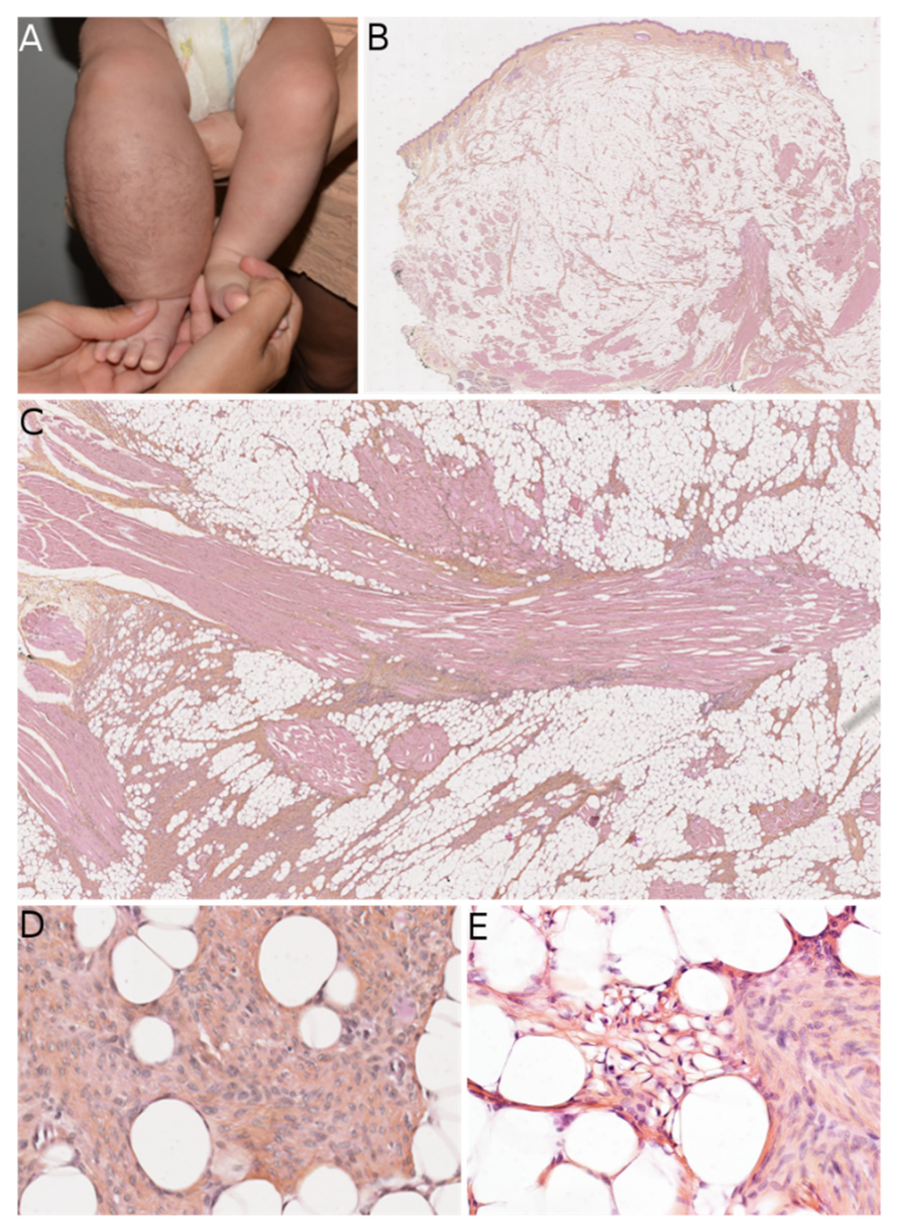 Dermatopathology 08 00035 g004 550