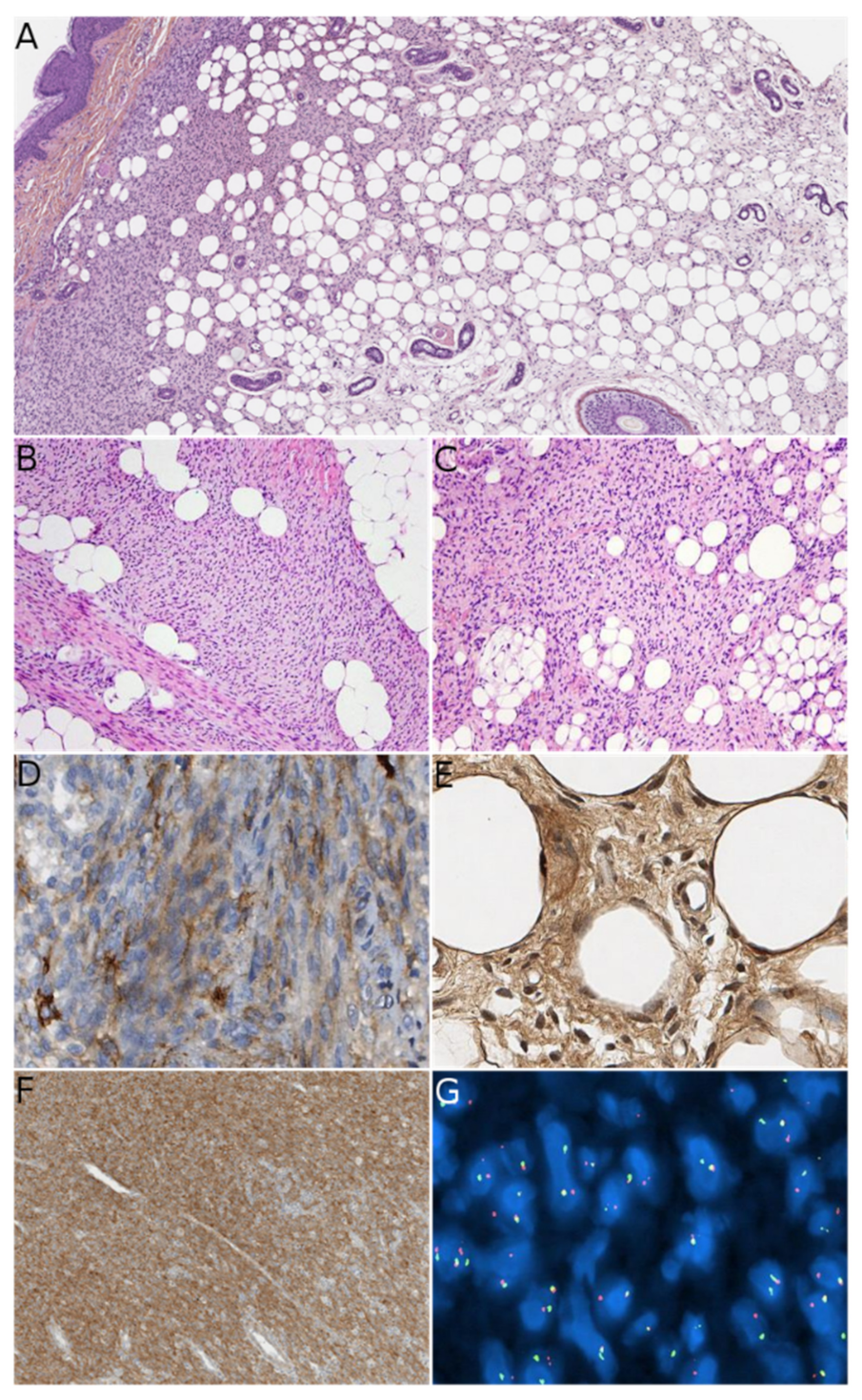 Dermatopathology 08 00035 g005 550