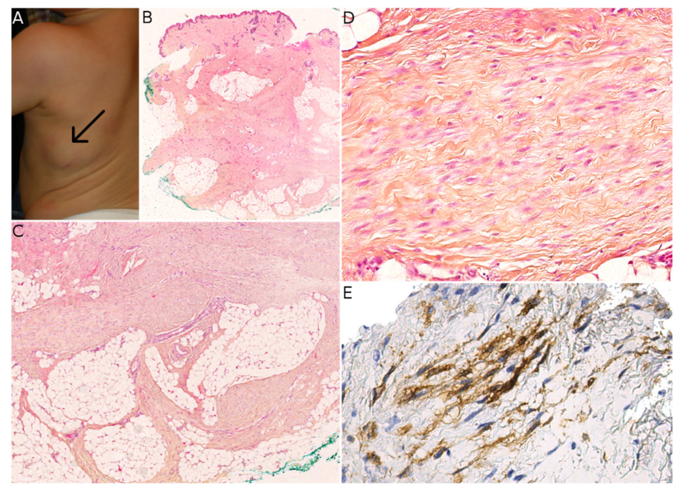 Dermatopathology 08 00035 g006 550
