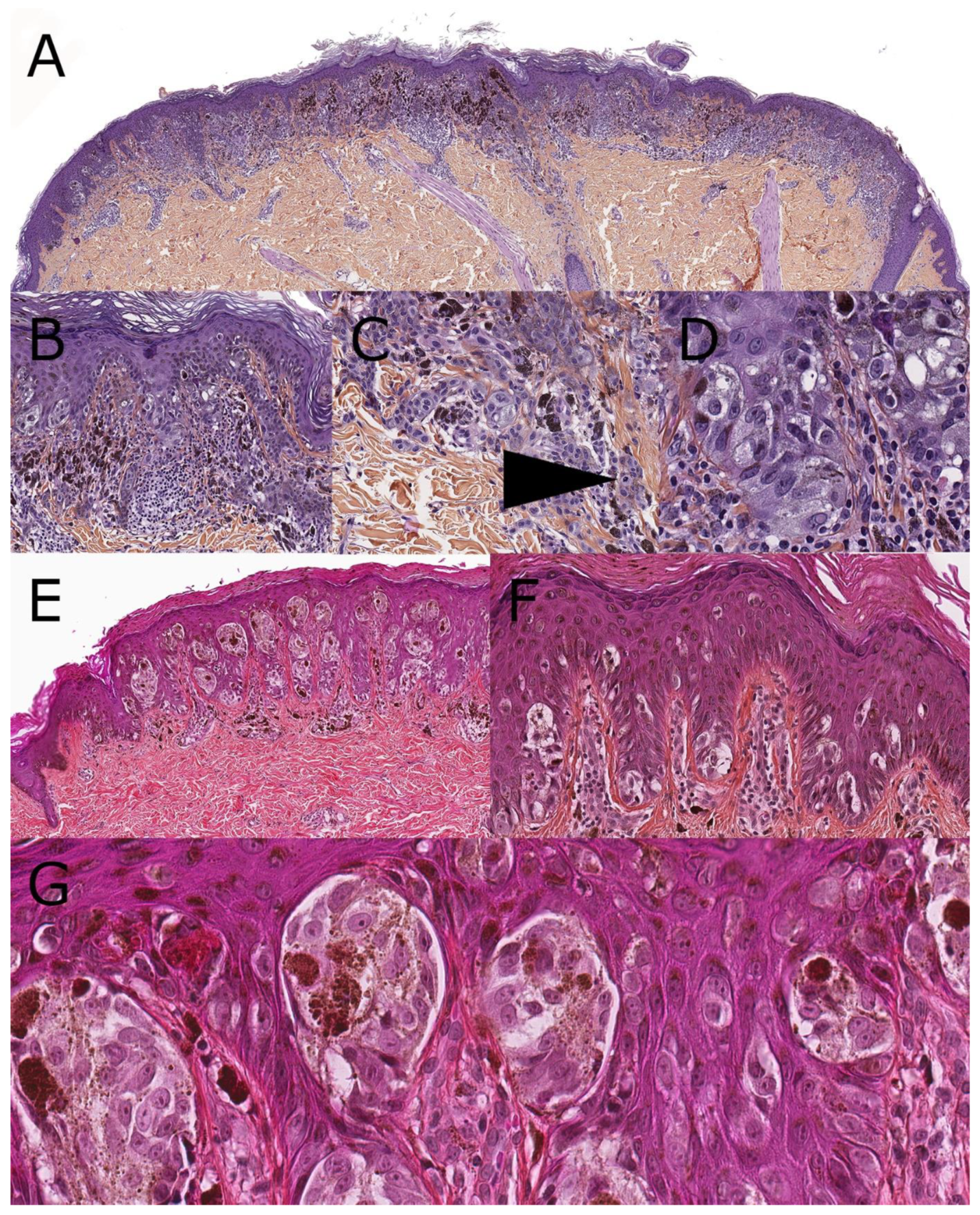 Dermatopathology 08 00036 g001