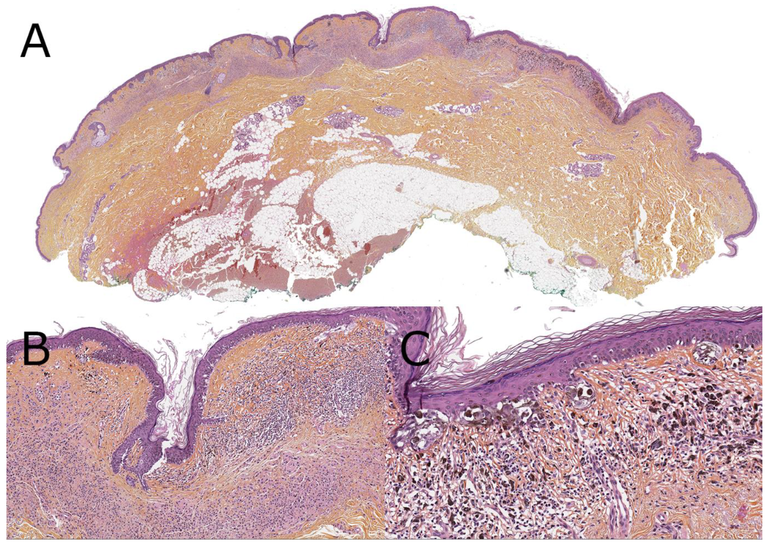 Dermatopathology 08 00036 g004