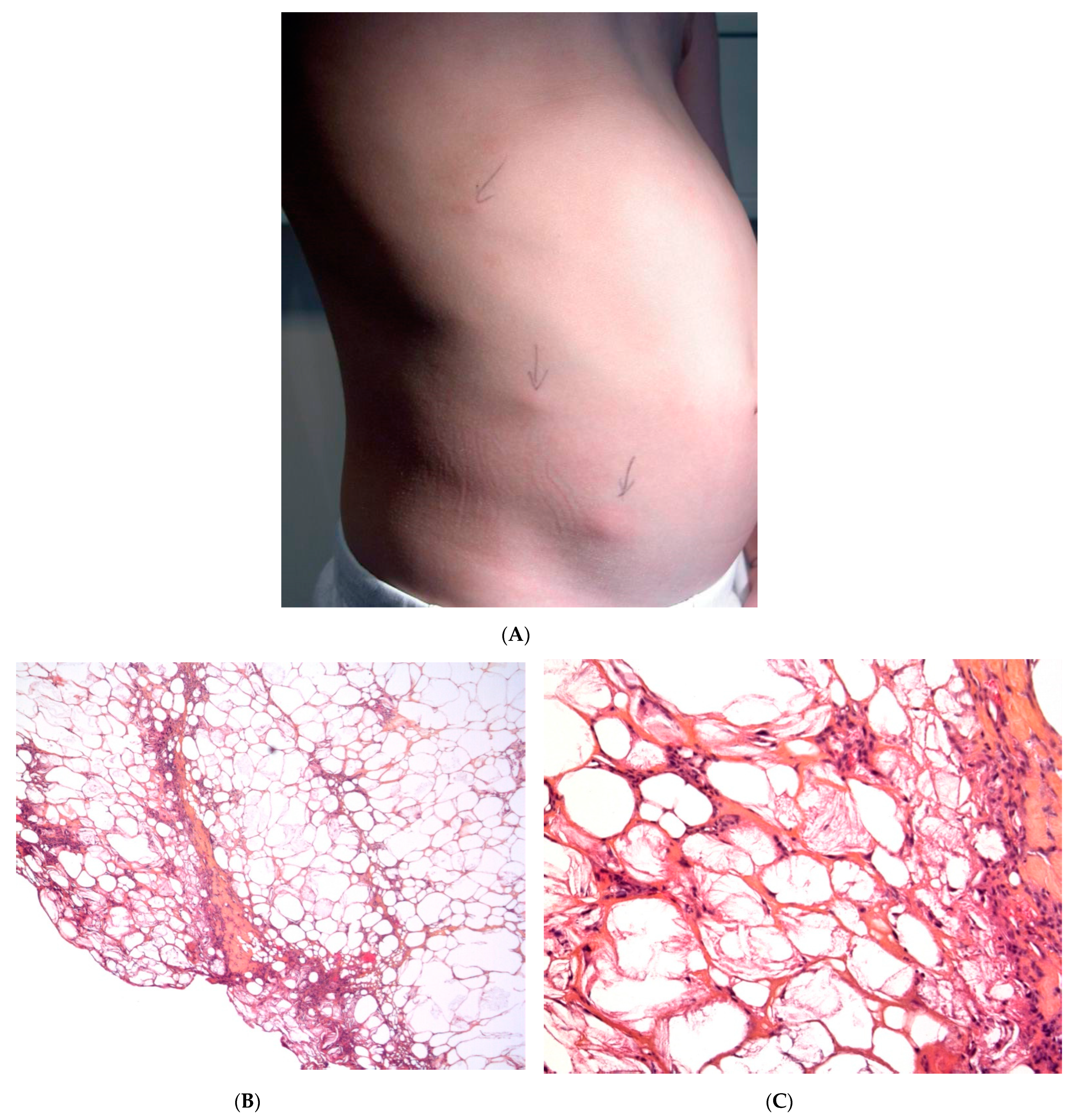 Dermatopathology 08 00037 g002 Dermatopathology 08 00037 g002