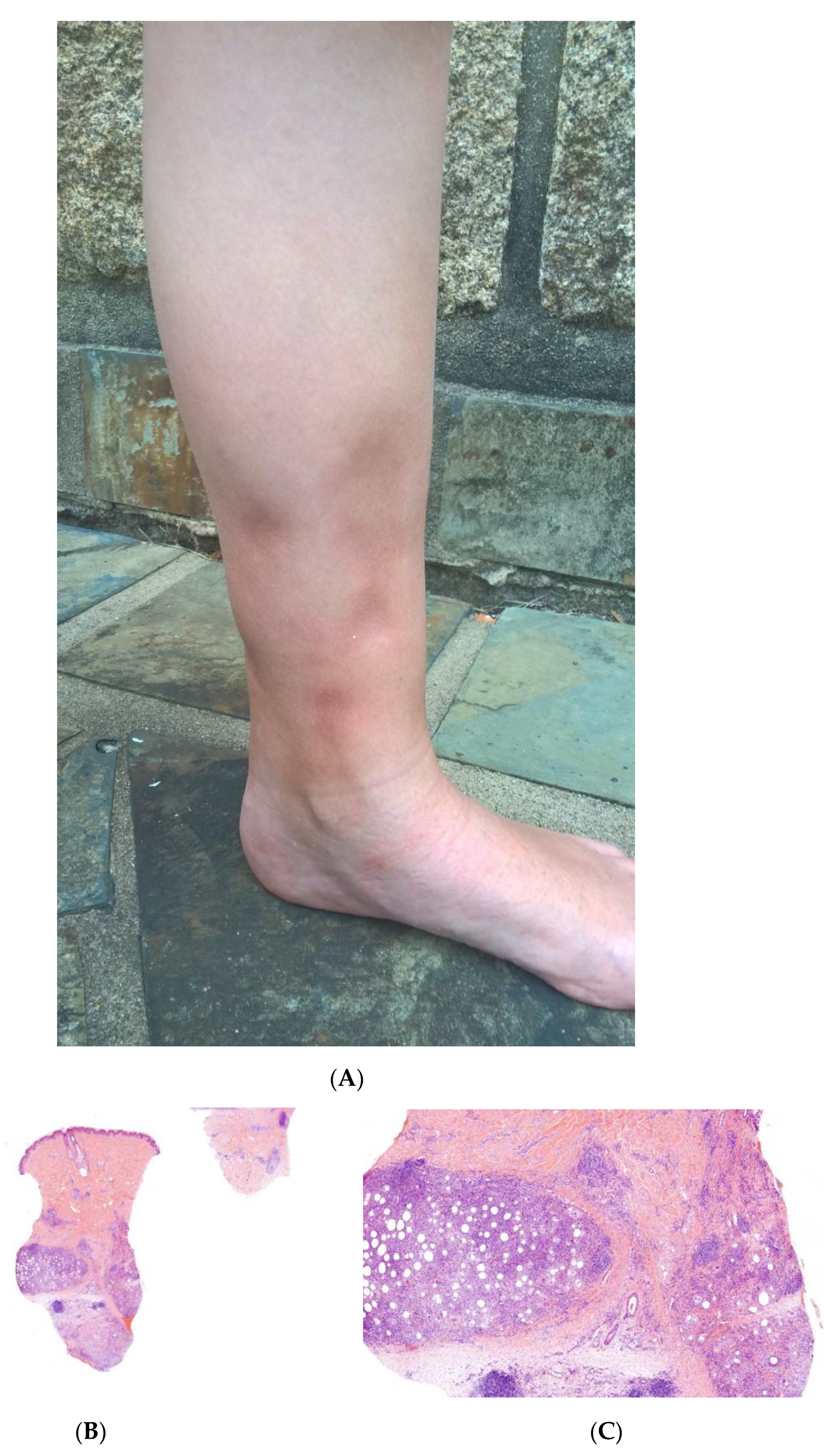 Dermatopathology 08 00037 g005 Dermatopathology 08 00037 g005