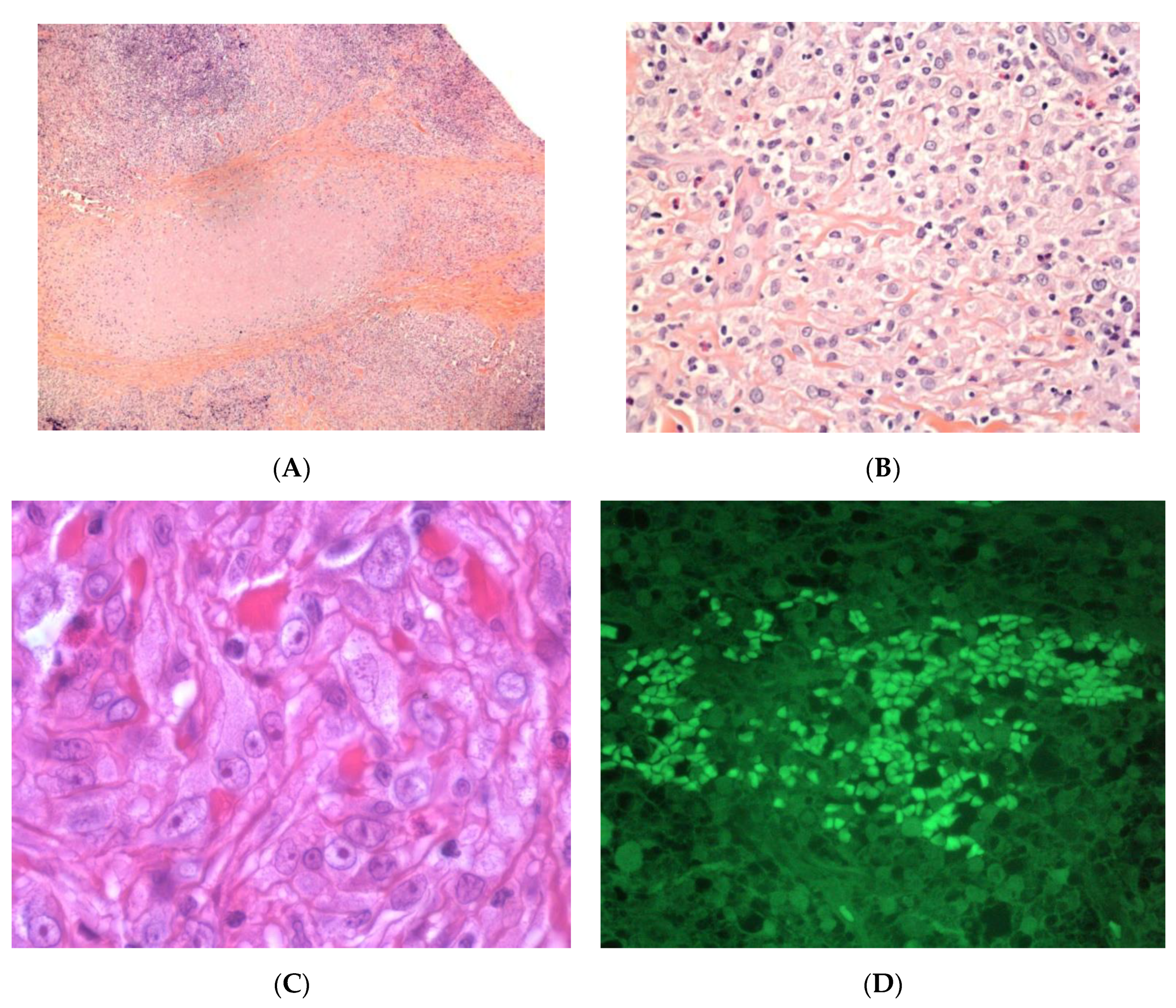 Dermatopathology 08 00037 g008 Dermatopathology 08 00037 g008