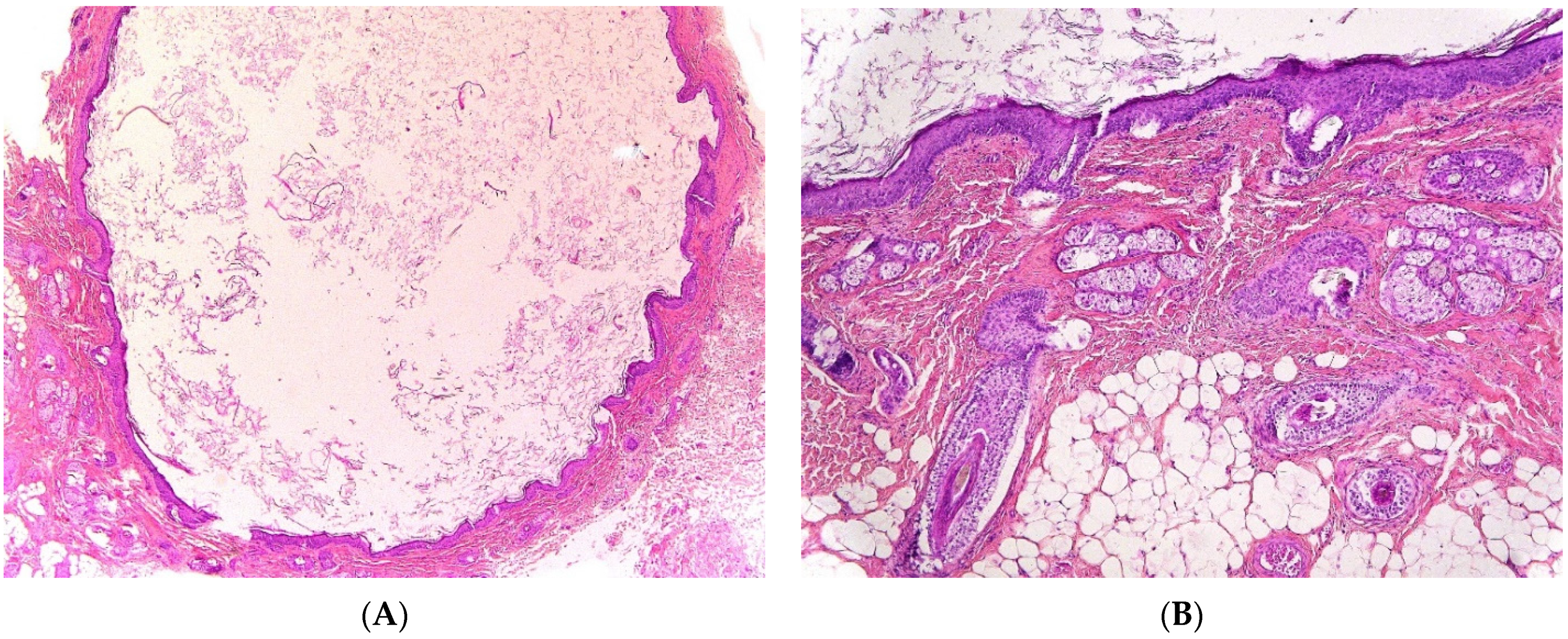 Dermatopathology 08 00039 g005a 550