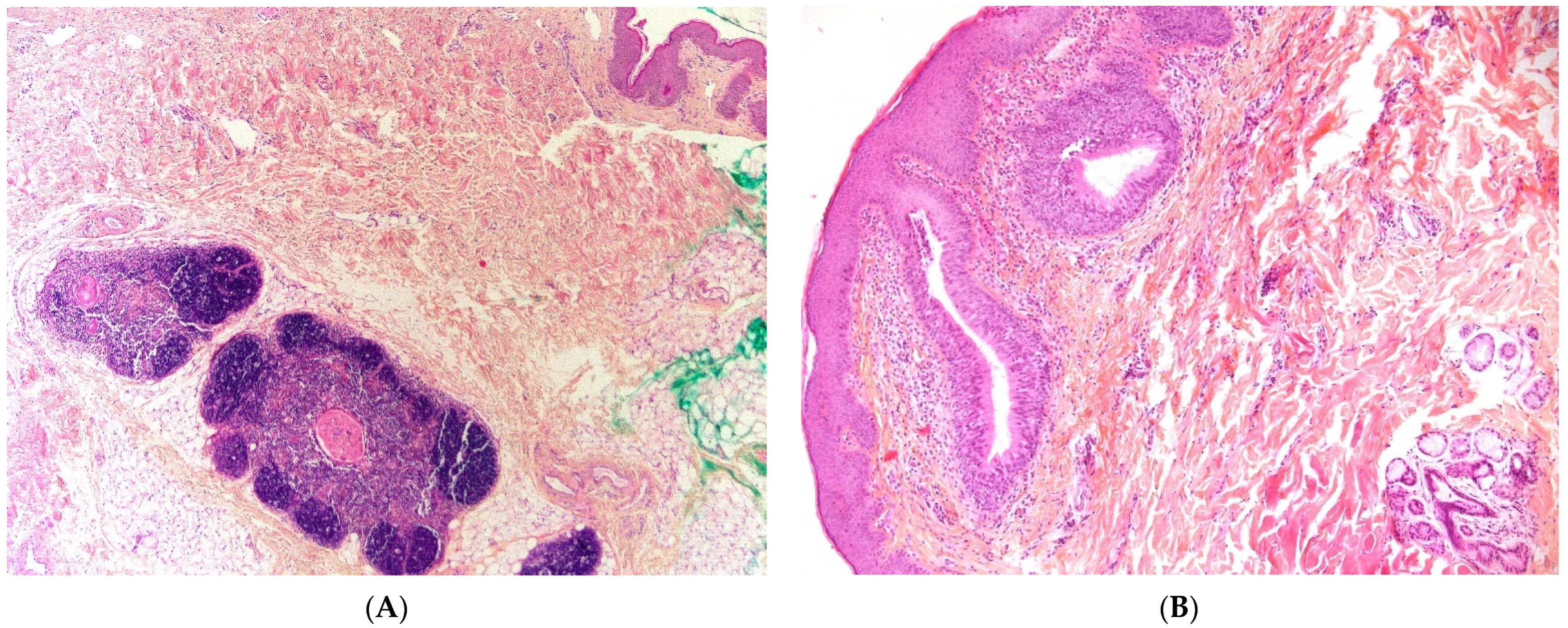 Dermatopathology 08 00039 g006 550