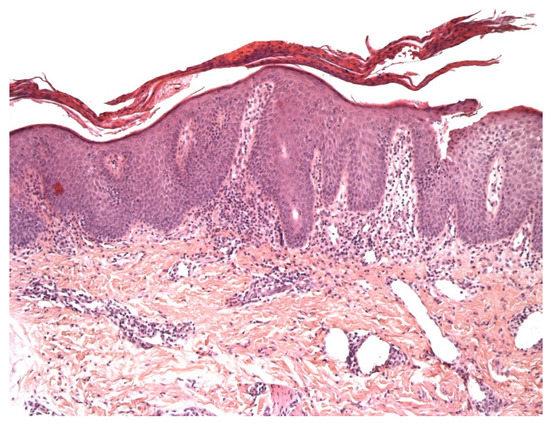 Dermatopathology 08 00042 g001 550