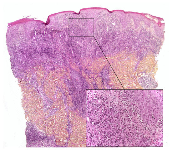 Dermatopathology 08 00042 g004 550