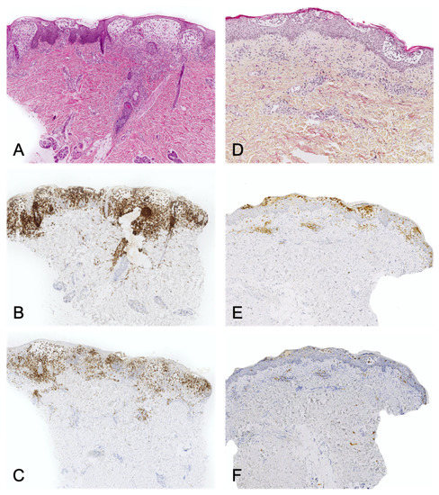 Dermatopathology 08 00042 g005 550