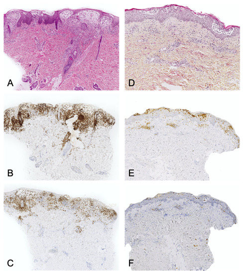 Dermatopathology 08 00042 g005 550