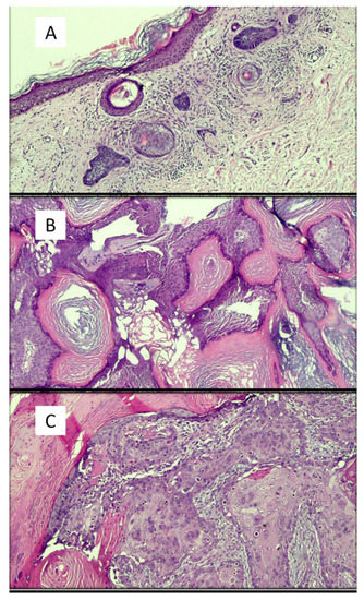 Dermatopathology Free Full Text Artificial Intelligence In