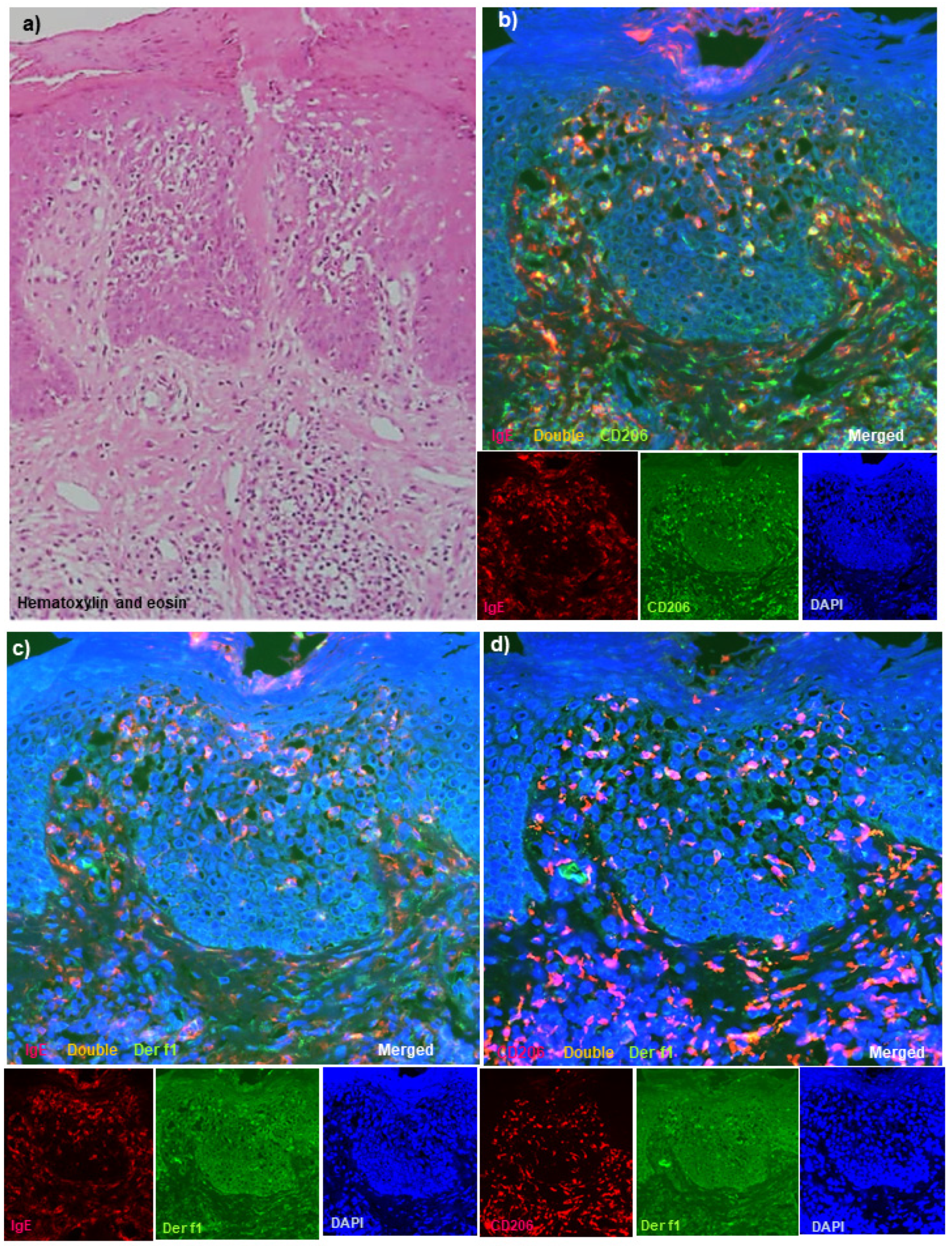 スーツ特別割引クーポン Immunohistopathological E Immunoglobulin of Analysis 洋書