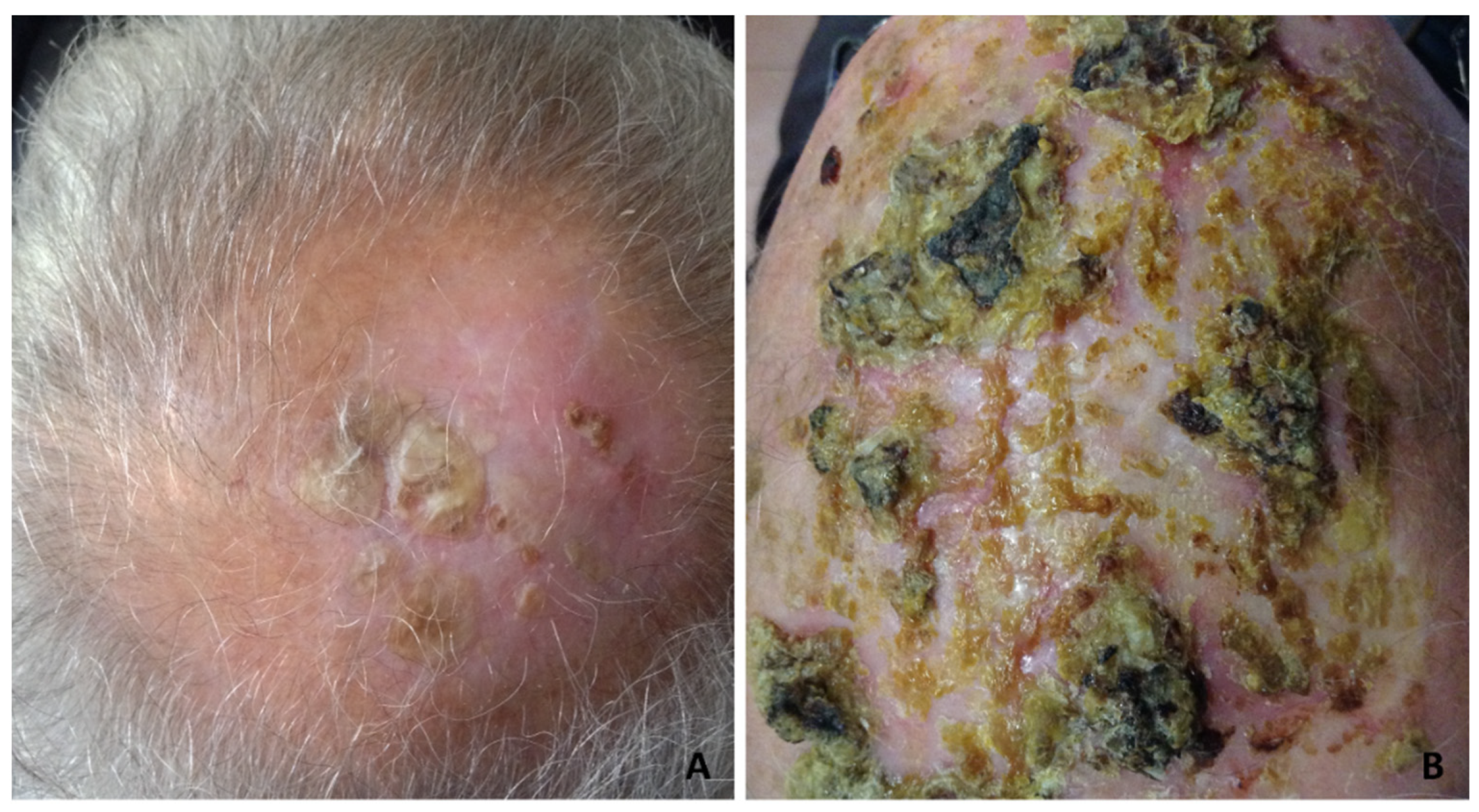 Dermatopathology 08 00048 g002 Dermatopathology 08 00048 g002