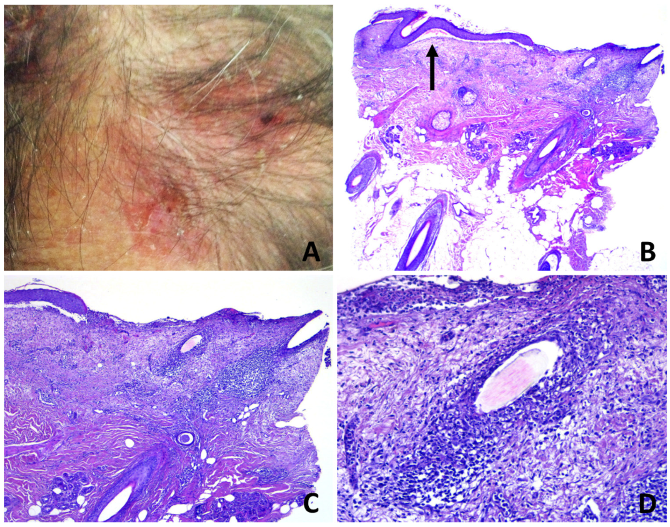 Dermatopathology 08 00048 g003 Dermatopathology 08 00048 g003