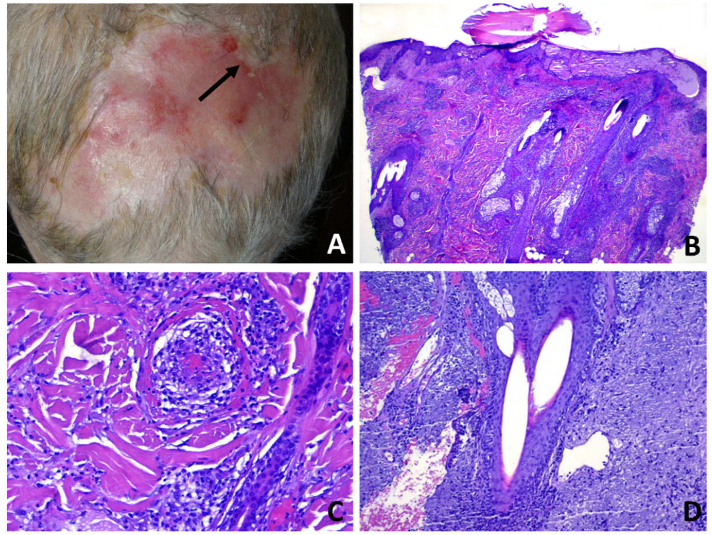 Dermatopathology 08 00048 g005 Dermatopathology 08 00048 g005