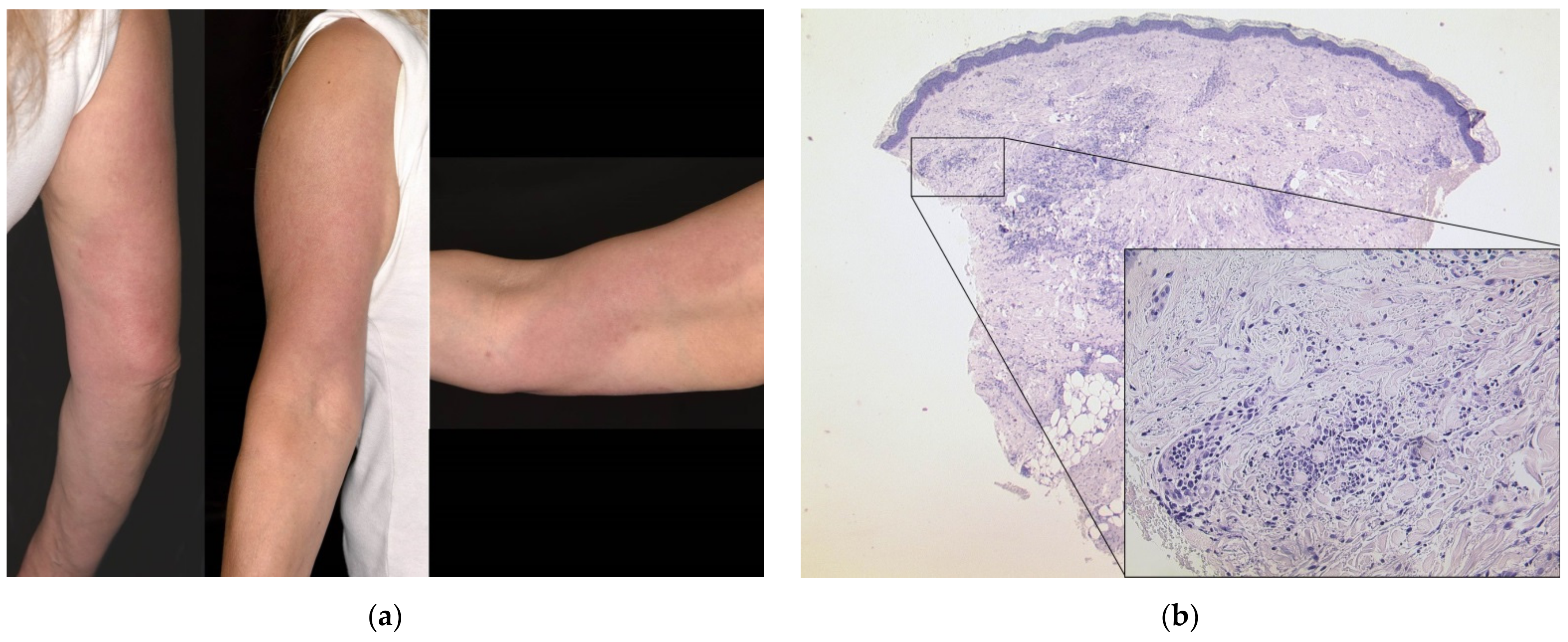 Dermatopathology 08 00049 g001