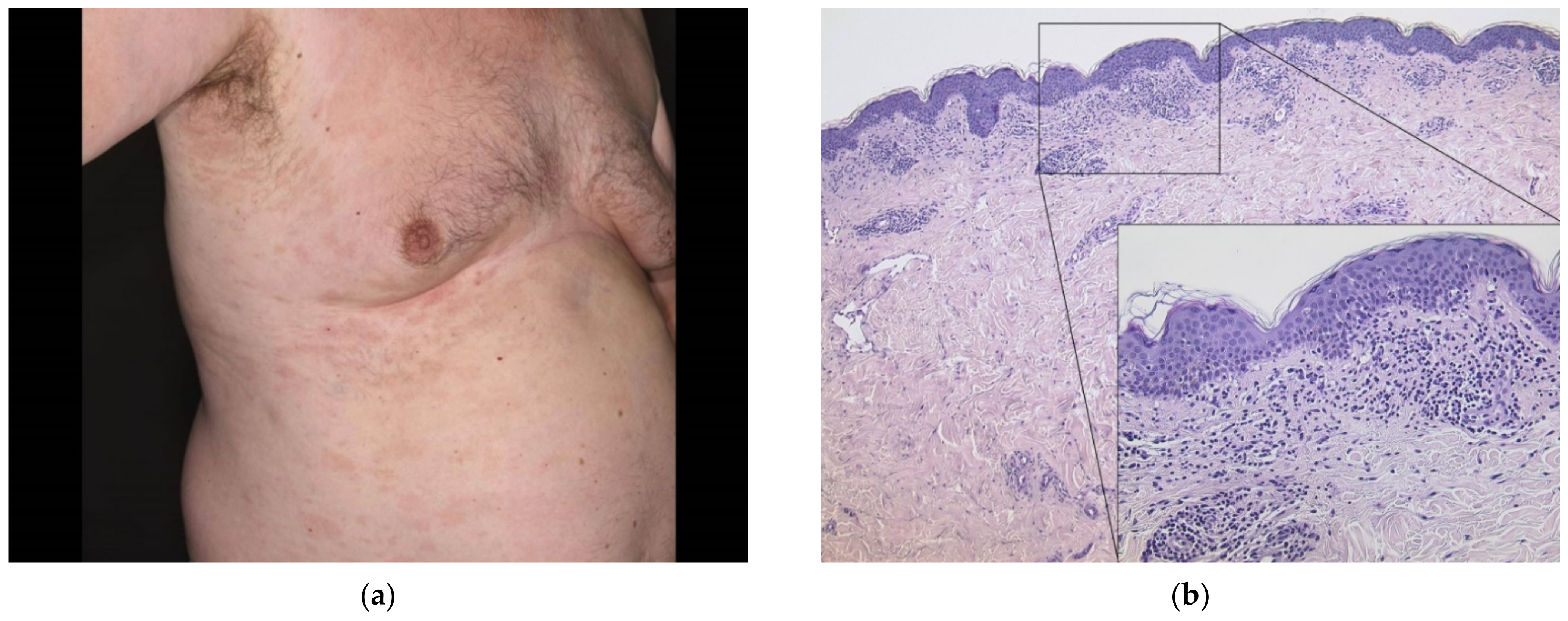 Dermatopathology 08 00049 g006