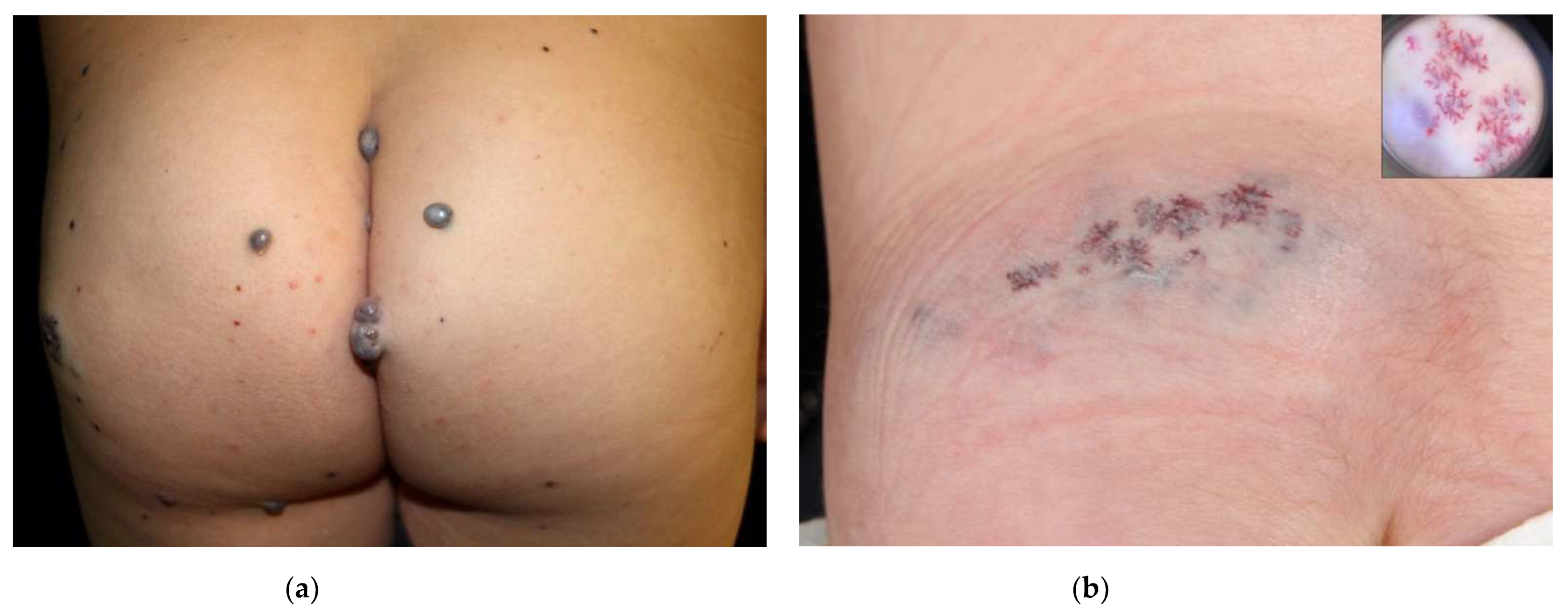 Dermatopathology 08 00050 g004a 550